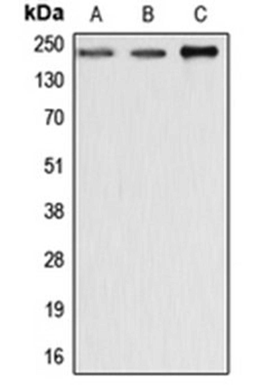 Western blot analysis of MCF7 (Lane 1), SP2/0 (Lane 2), rat liver (Lane 3) whole cell lysates using DYSF antibody