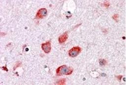 Immunohistochemistry-Paraffin: RPL22 Antibody [NBP1-06069] - (3.8 ug/ml) staining of paraffin embedded Human Cortex Steamed antigen retrieval with citrate buffer pH 6, AP-staining.