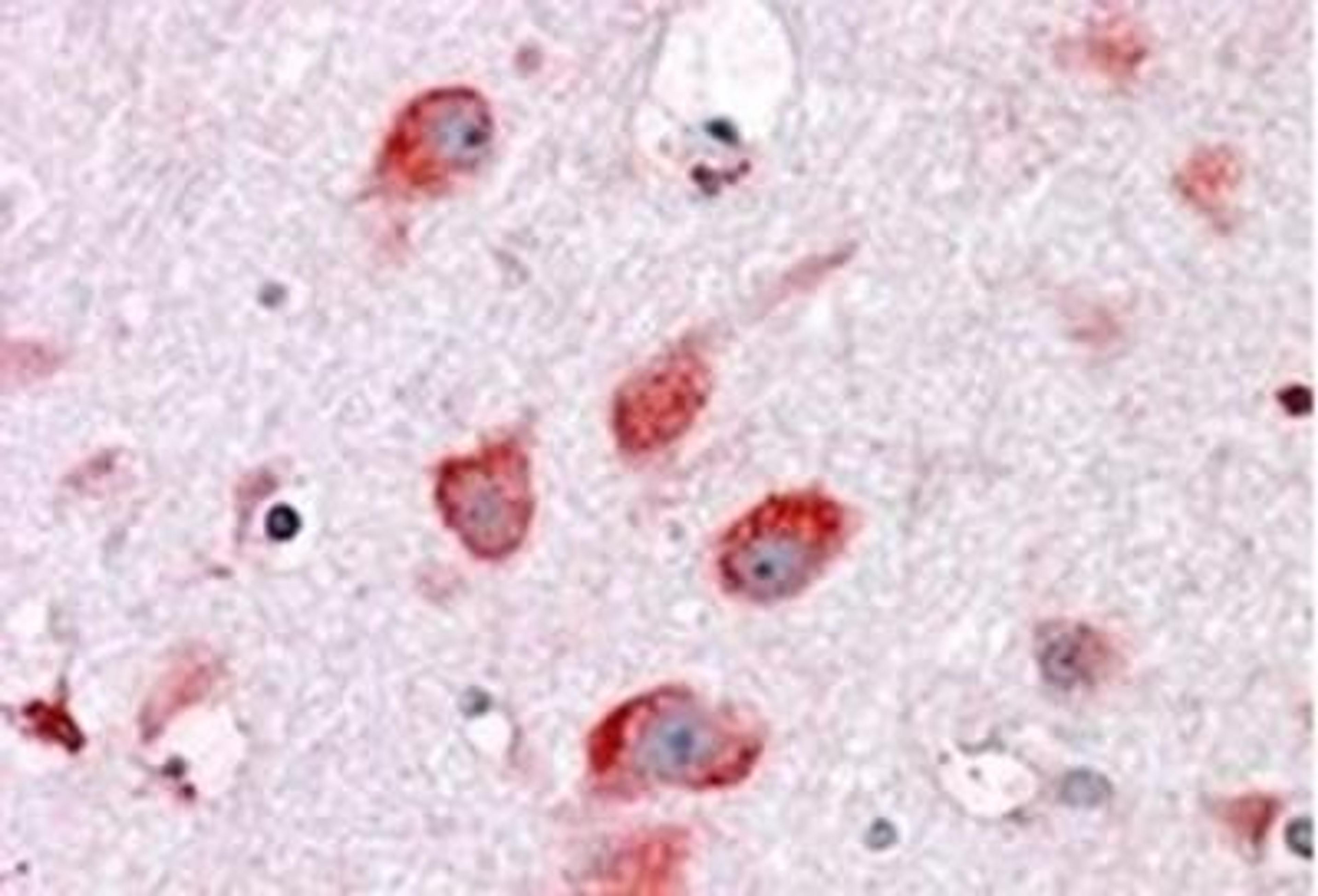 Immunohistochemistry-Paraffin: RPL22 Antibody [NBP1-06069] - (3.8 ug/ml) staining of paraffin embedded Human Cortex Steamed antigen retrieval with citrate buffer pH 6, AP-staining.