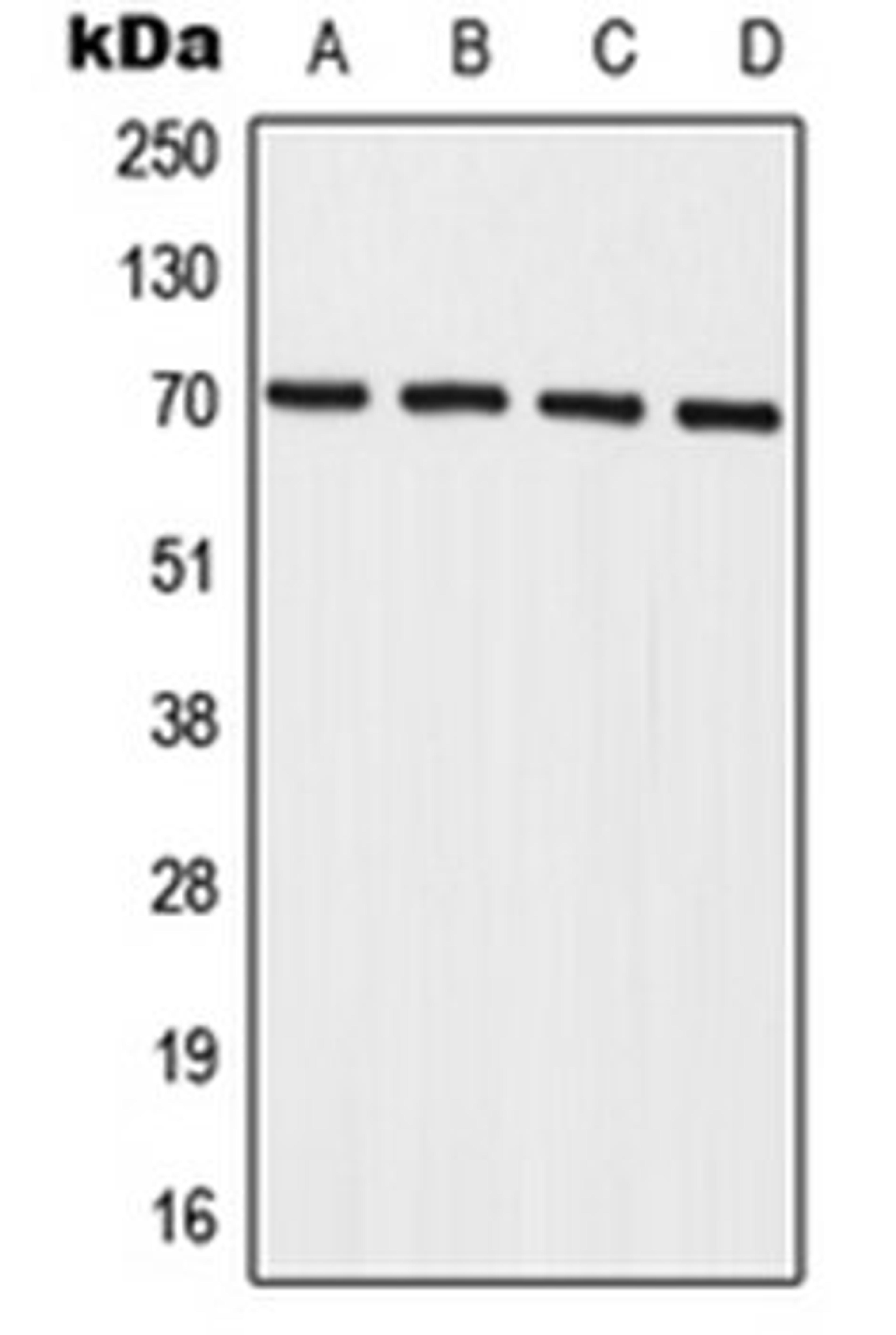 Western blot analysis of A549 (Lane 1), HeLa (Lane 2), mouse spleen (Lane 3), rat spleen (Lane 4) whole cell lysates using IL27RA antibody