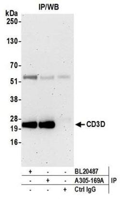 Detection of human CD3D by western blot of immunoprecipitates.