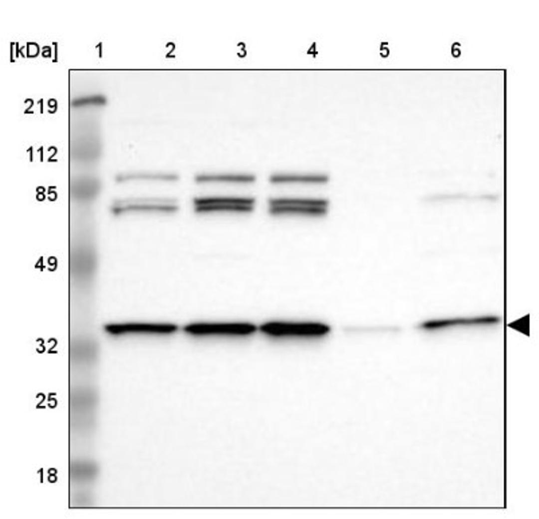 Western Blot: PQBP1 Antibody [NBP1-82619] - Lane 1: Marker [kDa] 219, 112, 85, 49, 32, 25, 18<br/>Lane 2: Human cell line RT-4<br/>Lane 3: Human cell line U-251MG sp<br/>Lane 4: Human cell line A-431<br/>Lane 5: Human liver tissue<br/>Lane 6: Human tonsil tissue