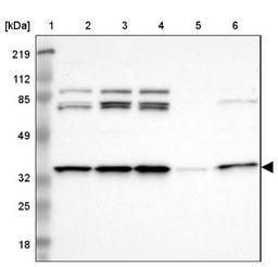 Western Blot: PQBP1 Antibody [NBP1-82619] - Lane 1: Marker [kDa] 219, 112, 85, 49, 32, 25, 18<br/>Lane 2: Human cell line RT-4<br/>Lane 3: Human cell line U-251MG sp<br/>Lane 4: Human cell line A-431<br/>Lane 5: Human liver tissue<br/>Lane 6: Human tonsil tissue