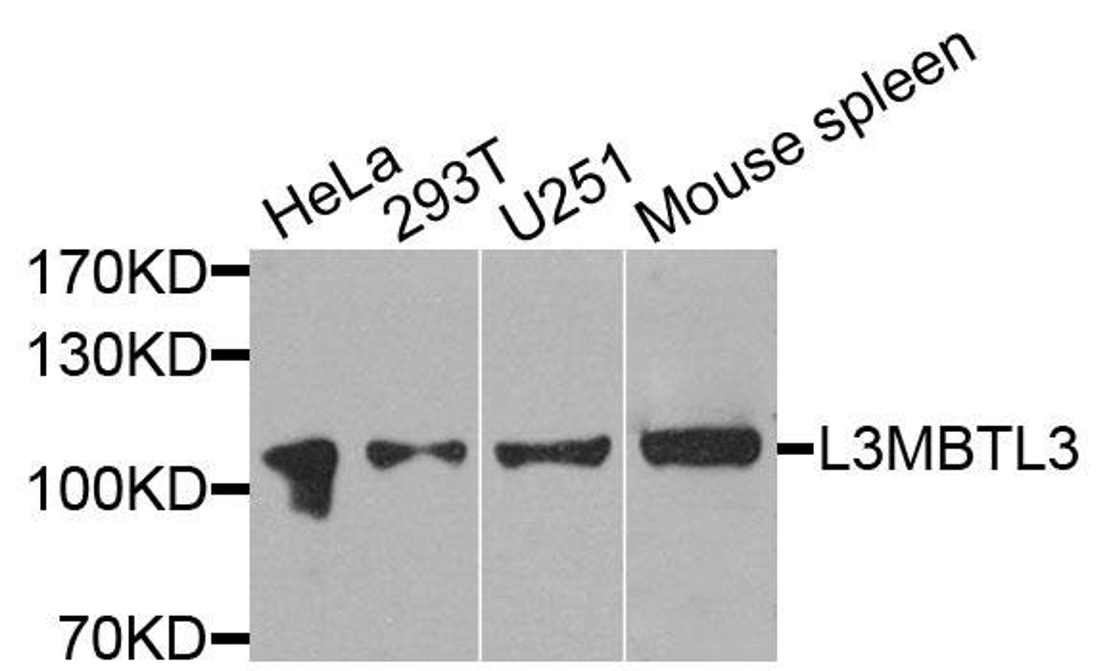 Western blot analysis of extracts of various cells using L3MBTL3 antibody