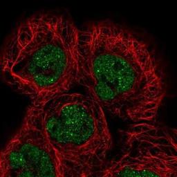 Immunocytochemistry/Immunofluorescence: ESRP1 Antibody [NBP1-82201] - Staining of human cell line A-431 shows positivity in nucleus but not nucleoli.