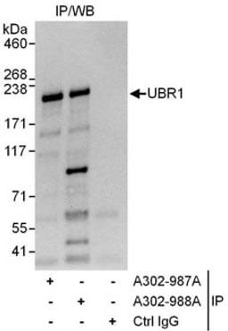 Detection of human UBR1 by western blot of immunoprecipitates.