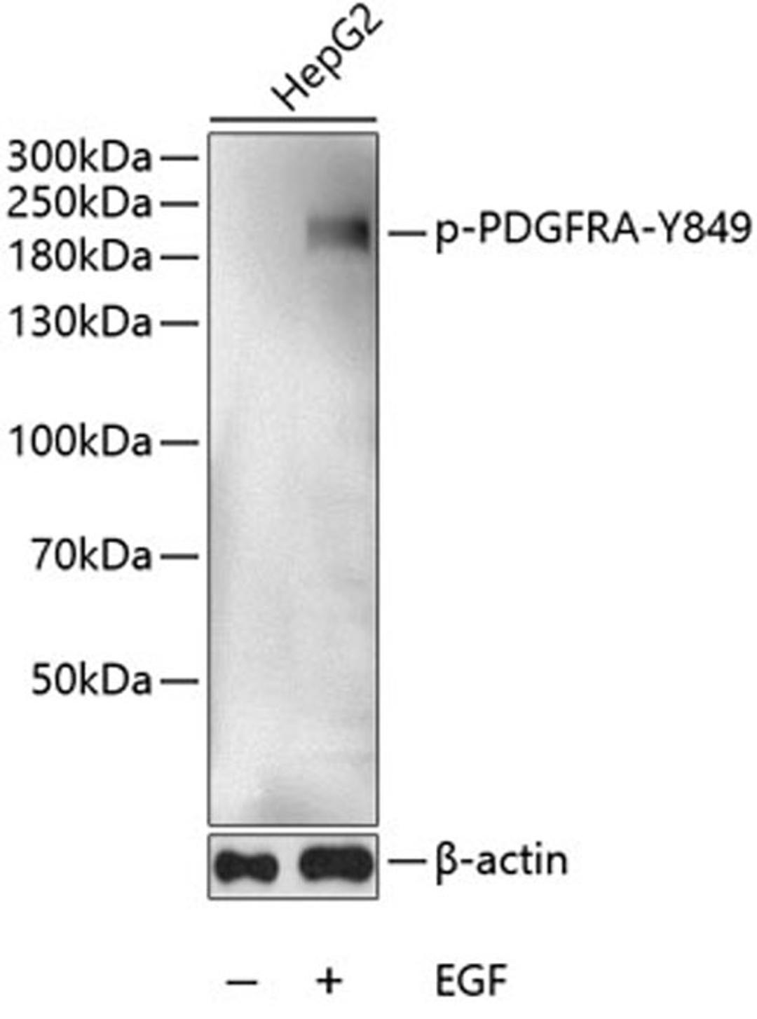 Western blot - Phospho-PDGFRA-Y849 antibody (AP0569)