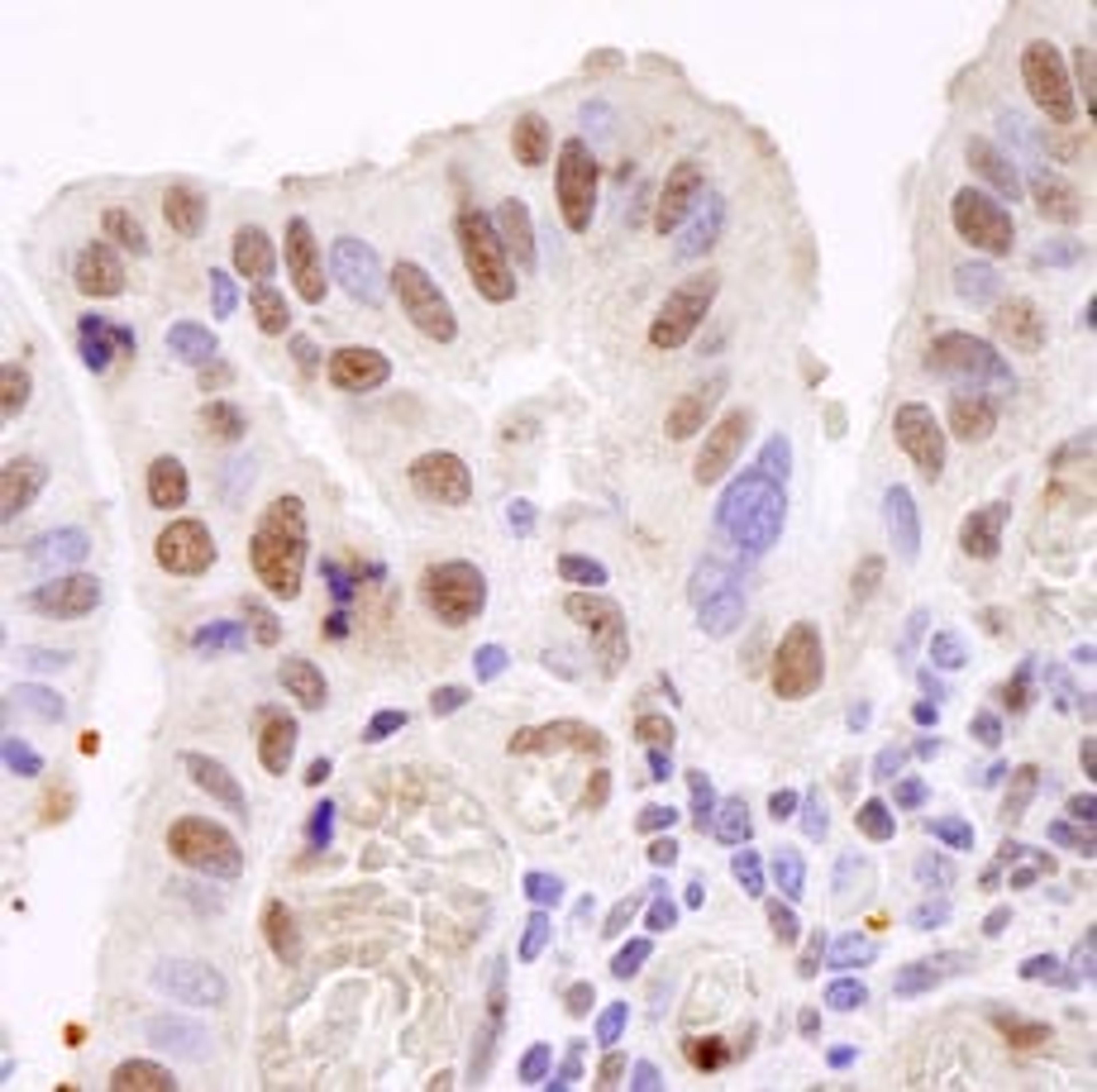 Detection of human TAFII68 by immunohistochemistry.