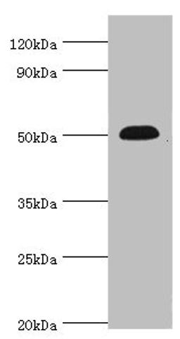 Western blot. All lanes: Neuronal acetylcholine receptor subunit alpha-5 antibody at 12ug/ml + Jurkat whole cell lysate. Secondary. Goat polyclonal to rabbit IgG at 1/10000 dilution. Predicted band size: 53 kDa. Observed band size: 53 kDa.