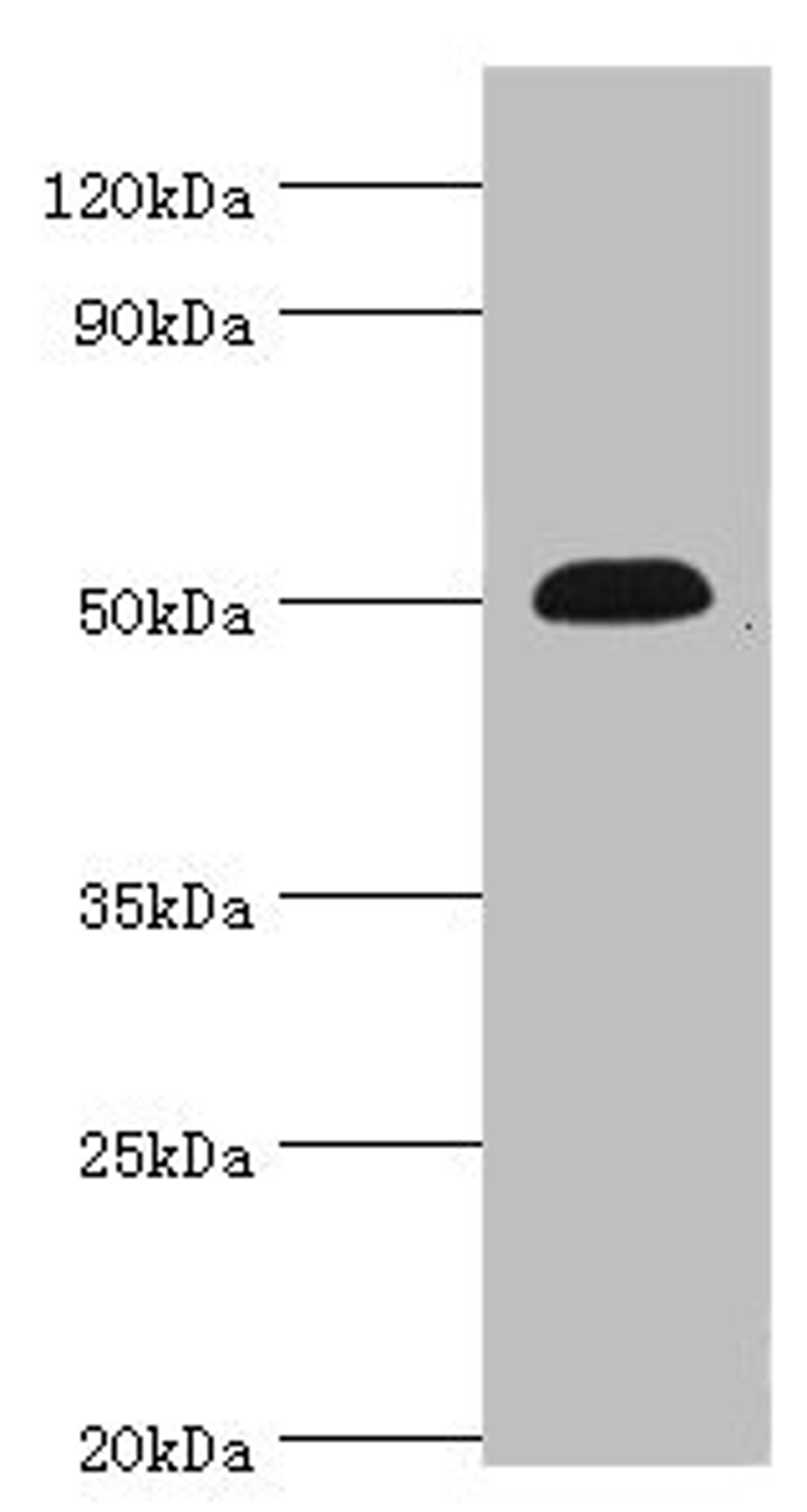 Western blot. All lanes: Neuronal acetylcholine receptor subunit alpha-5 antibody at 12ug/ml + Jurkat whole cell lysate. Secondary. Goat polyclonal to rabbit IgG at 1/10000 dilution. Predicted band size: 53 kDa. Observed band size: 53 kDa.