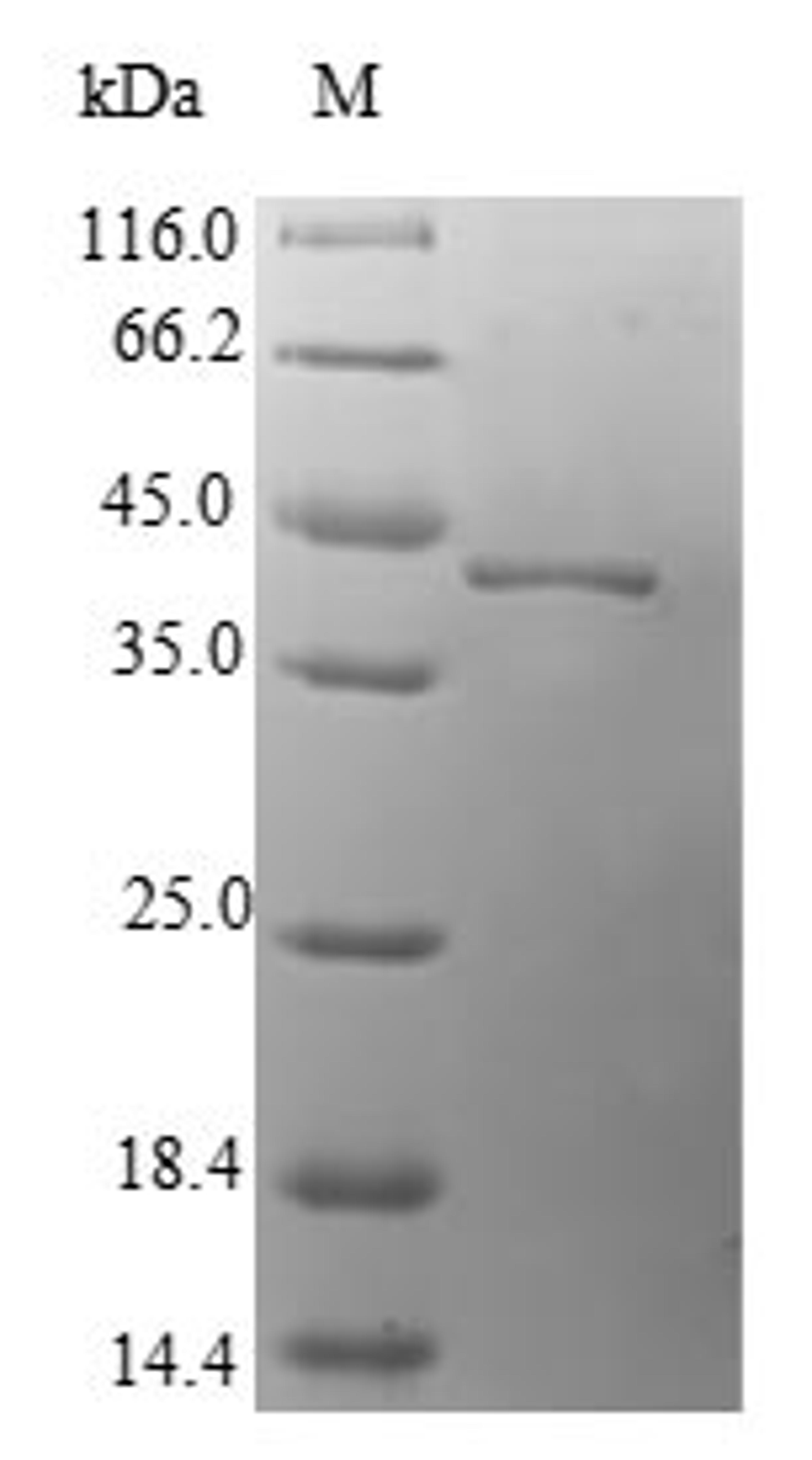 (Tris-Glycine gel) Discontinuous SDS-PAGE (reduced) with 5% enrichment gel and 15% separation gel.