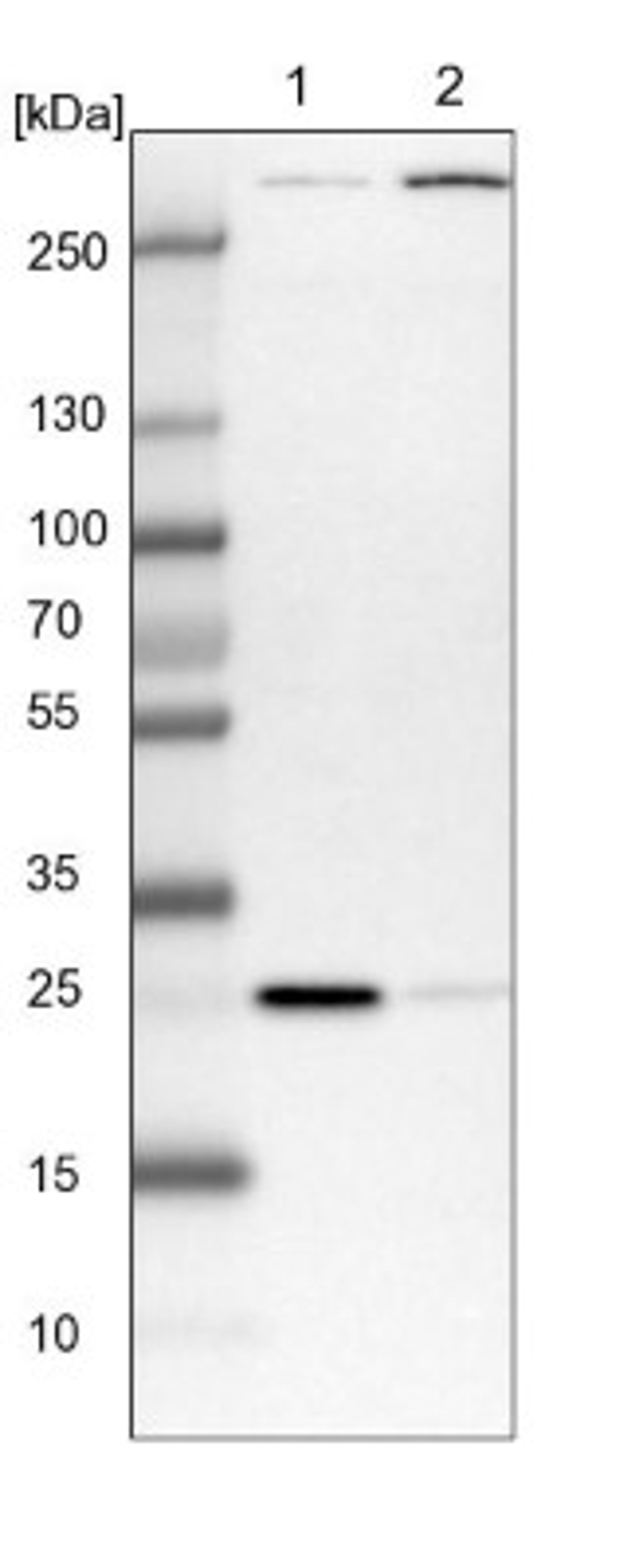 Western Blot: SELRC1 Antibody [NBP1-87392] - Lane 1: NIH-3T3 cell lysate (Mouse embryonic fibroblast cells)<br/>Lane 2: NBT-II cell lysate (Rat Wistar bladder tumour cells)