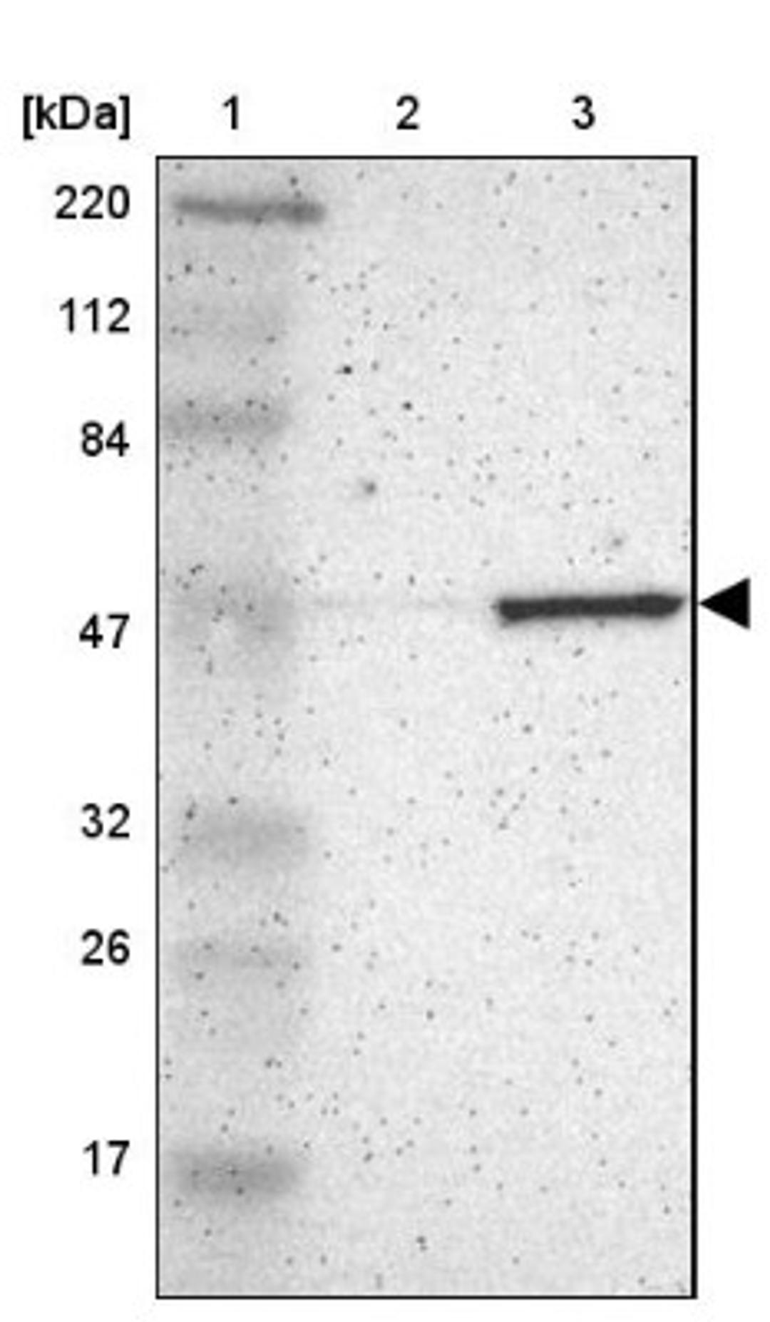 Western Blot: Fascin Antibody [NBP1-91887] - Lane 1: Marker [kDa] 220, 112, 84, 47, 32, 26, 17<br/>Lane 2: Human cell line RT-4<br/>Lane 3: Human cell line U-251MG sp