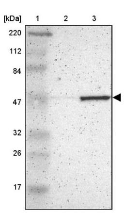 Western Blot: Fascin Antibody [NBP1-91887] - Lane 1: Marker [kDa] 220, 112, 84, 47, 32, 26, 17<br/>Lane 2: Human cell line RT-4<br/>Lane 3: Human cell line U-251MG sp