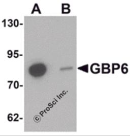 Western blot analysis of GBP6 in Hela cell lysate with GBP6 antibody at 0.5 μg/mL in (A) the absence and (B) the presence of blocking peptide.