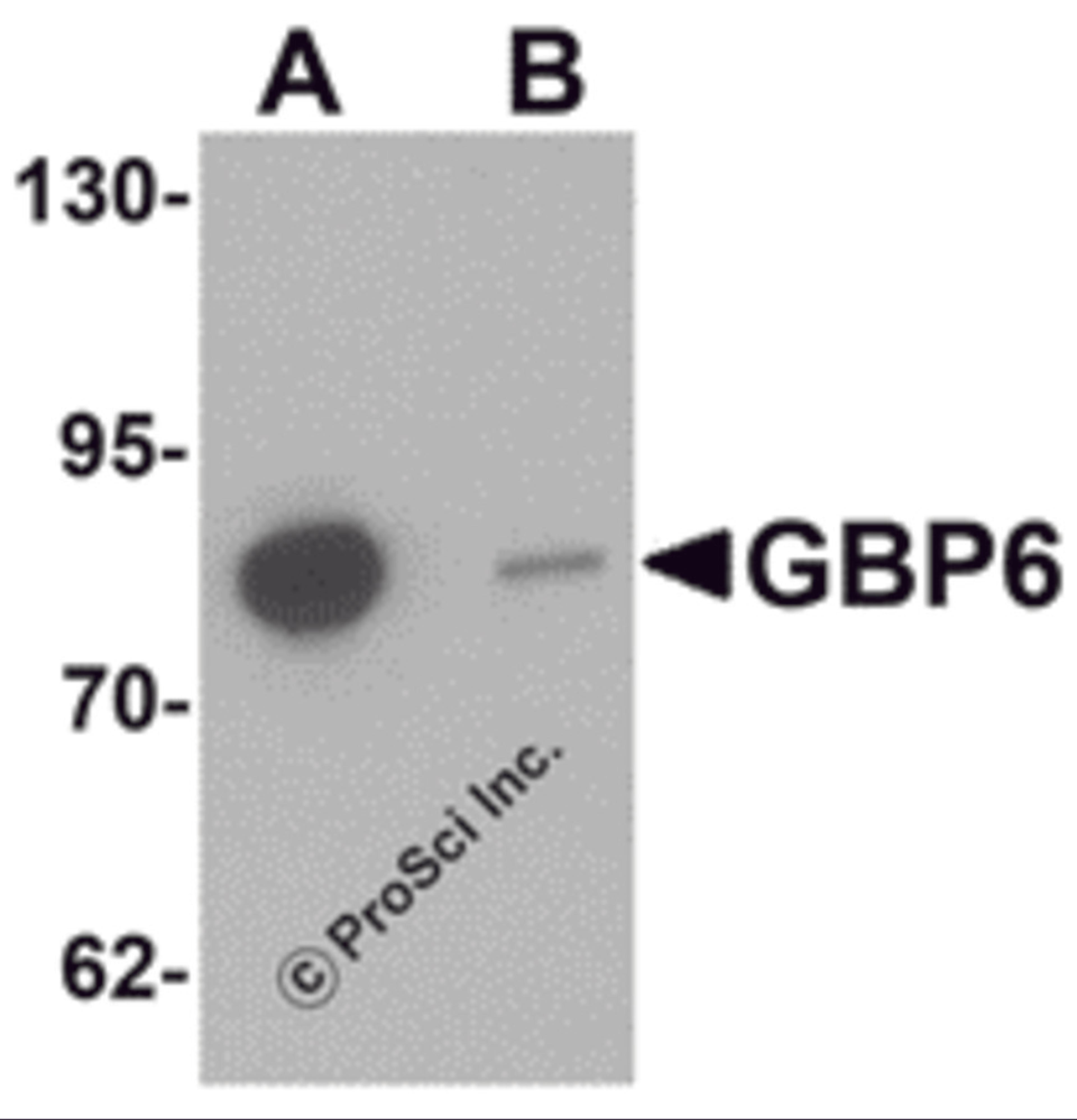 Western blot analysis of GBP6 in Hela cell lysate with GBP6 antibody at 0.5 μg/mL in (A) the absence and (B) the presence of blocking peptide.