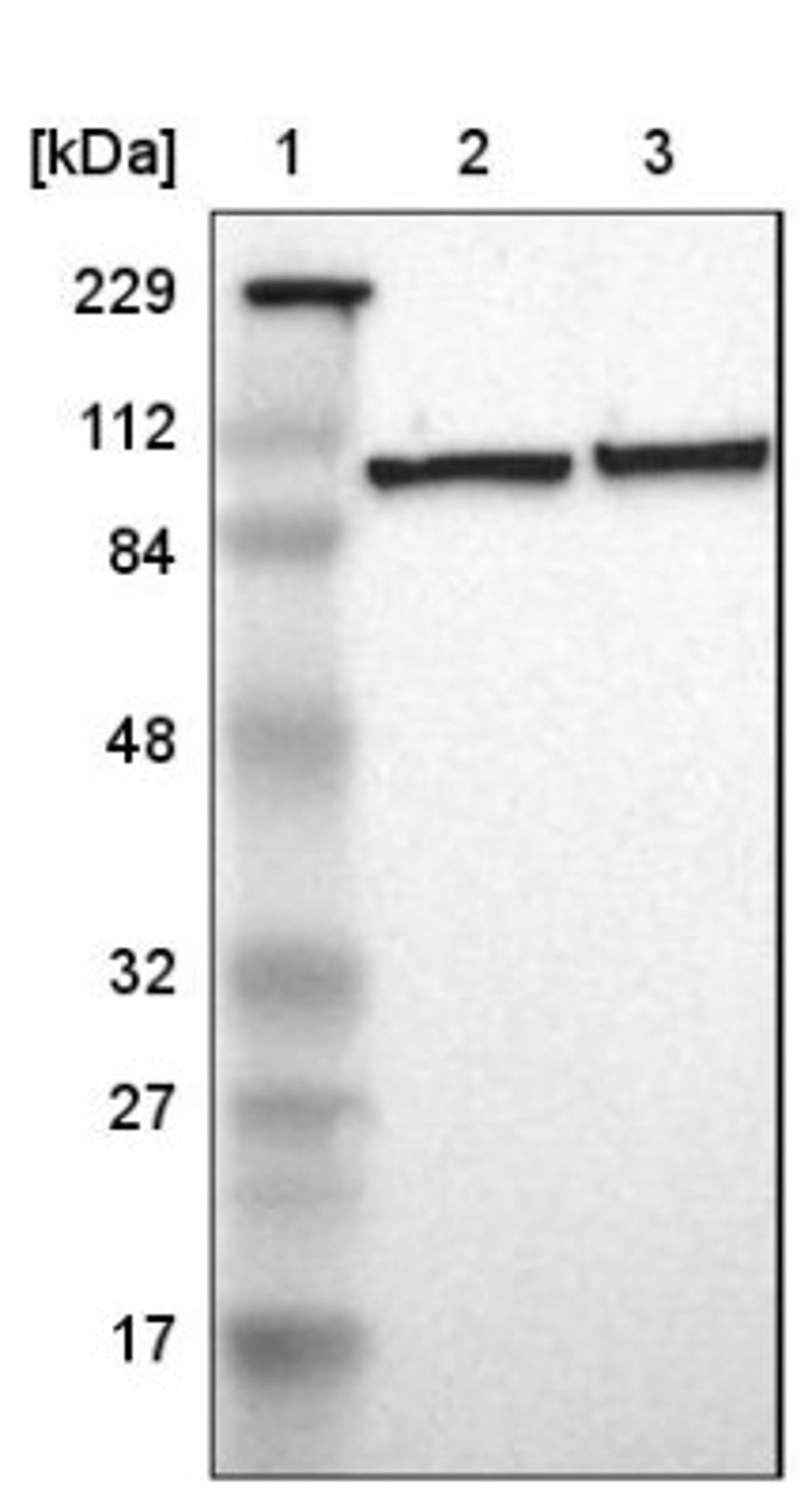 Western Blot: FAM62B Antibody [NBP1-85627] - Lane 1: Marker [kDa] 229, 112, 84, 48, 32, 27, 17<br/>Lane 2: Human cell line RT-4<br/>Lane 3: Human cell line U-251MG sp