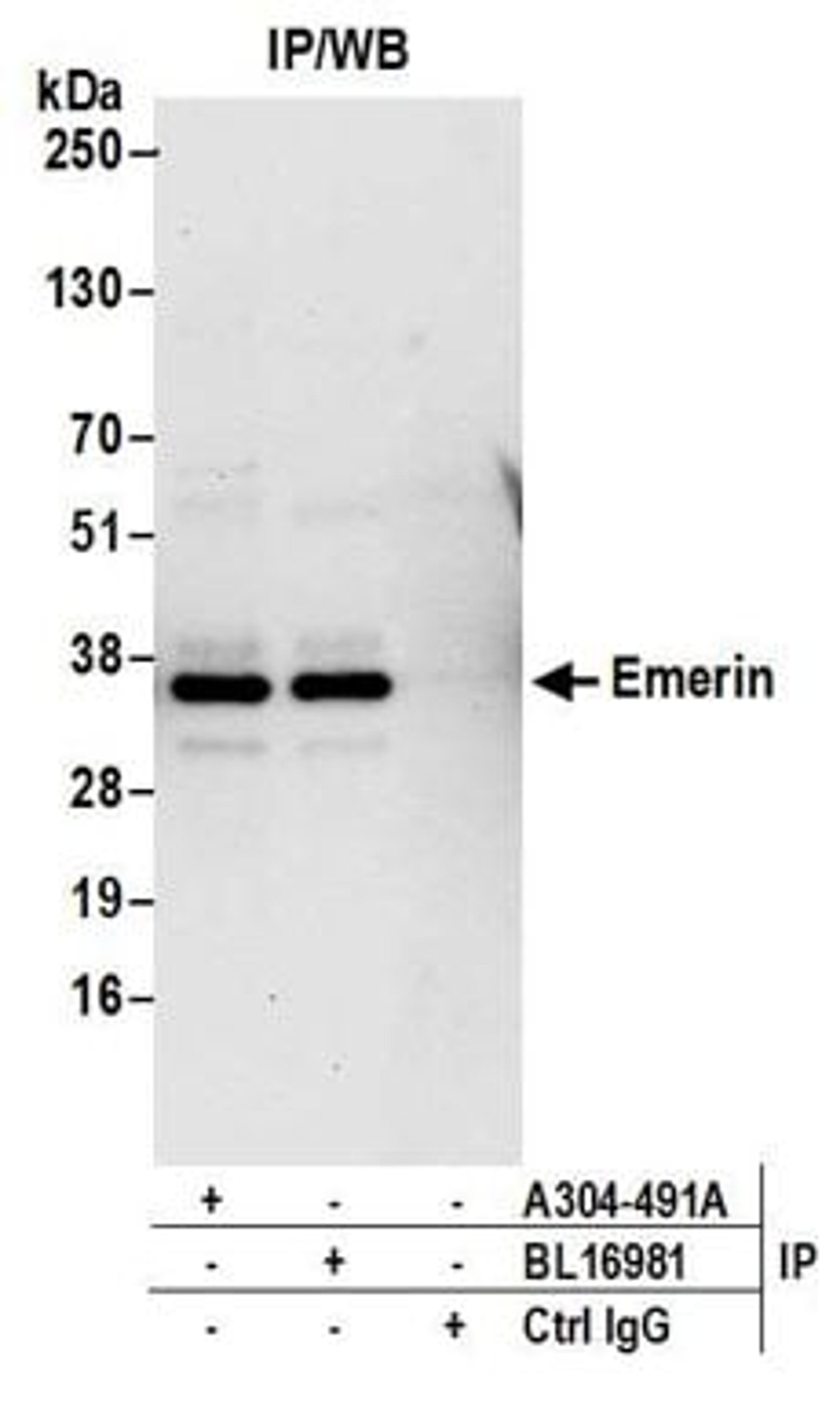 Detection of human Emerin by western blot of immunoprecipitates.