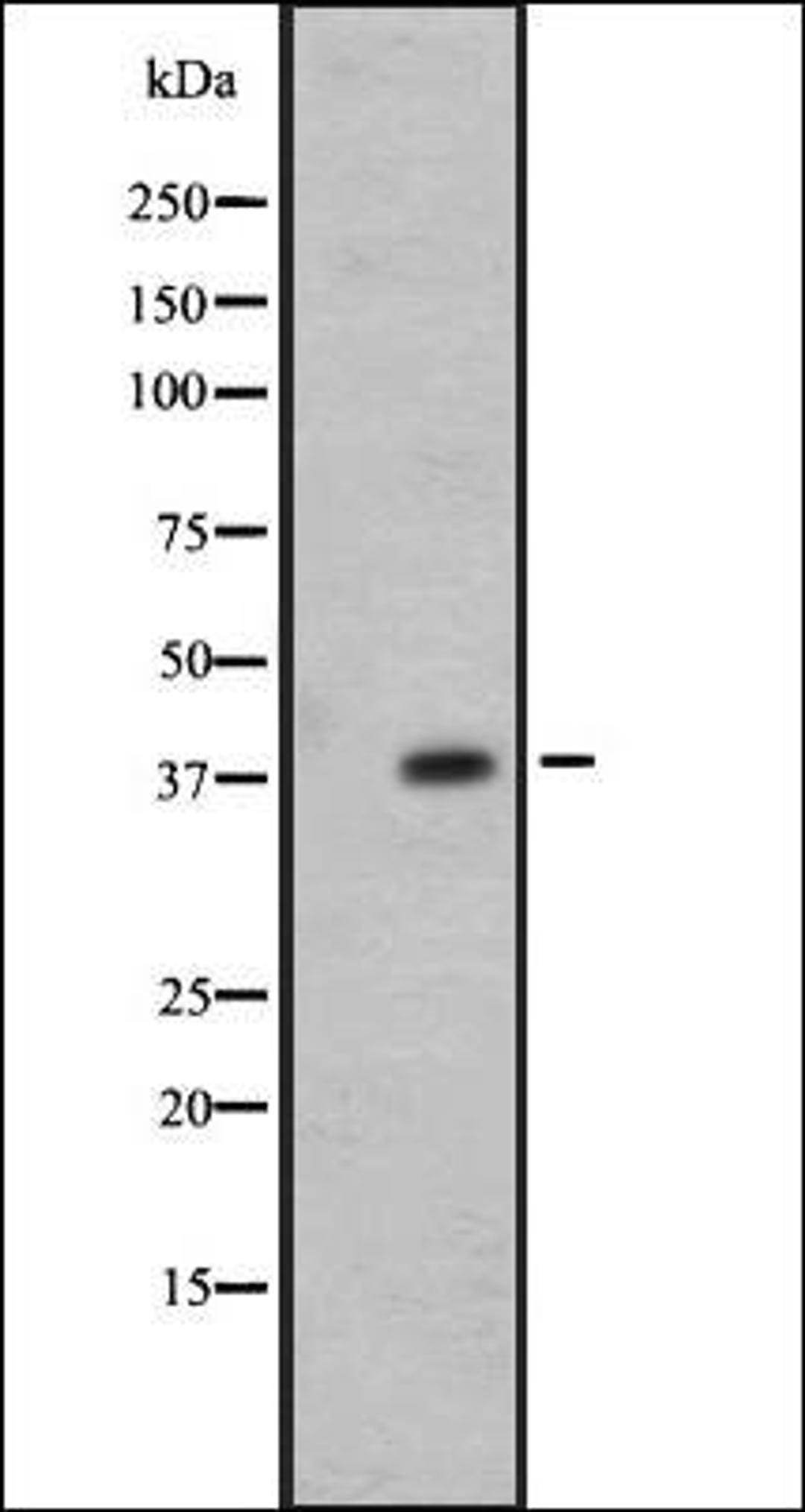 Western blot analysis of 721_B whole cell lysate using OR7E24 antibody