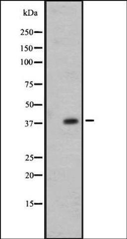 Western blot analysis of 721_B whole cell lysate using OR7E24 antibody