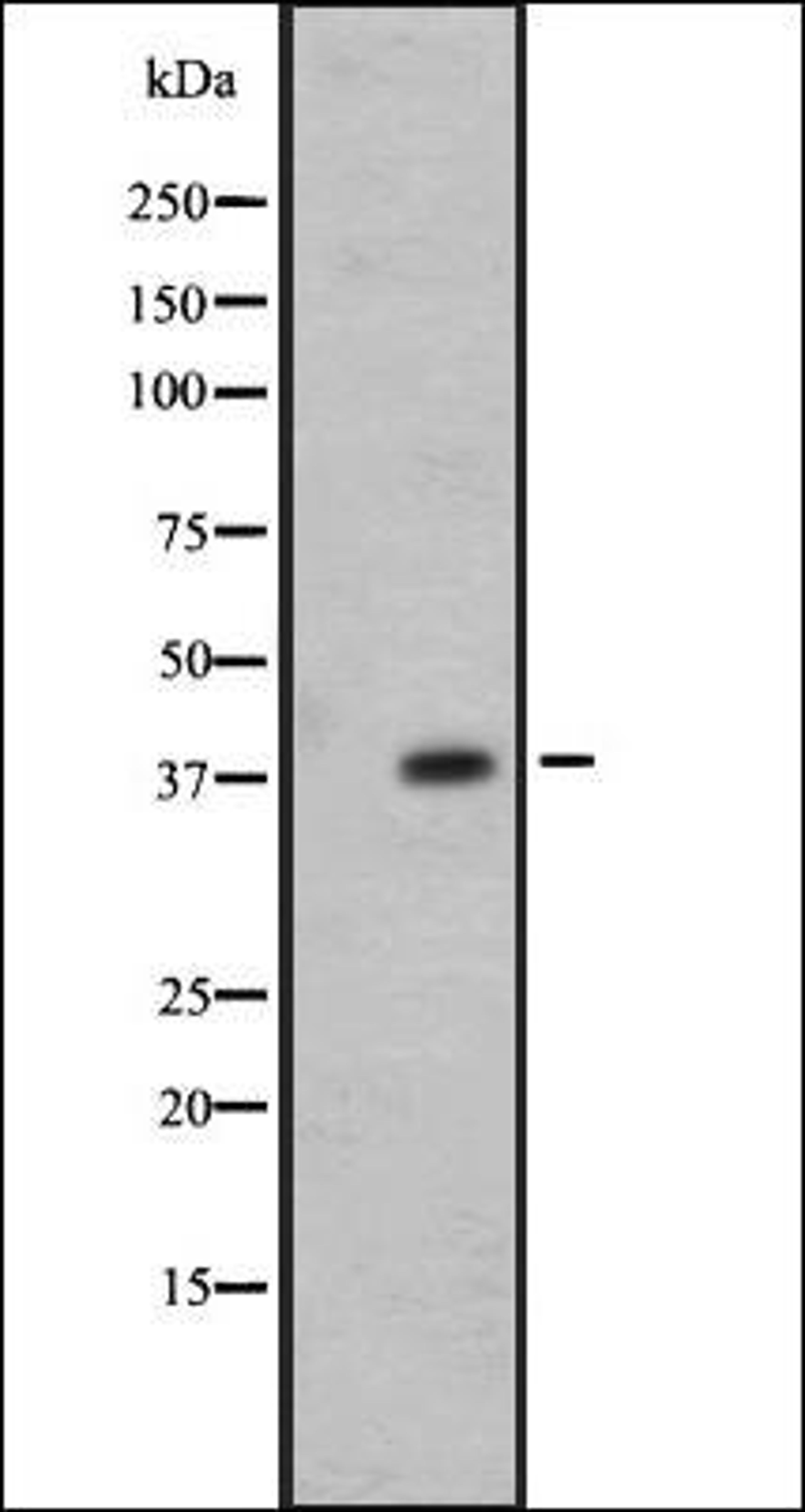 Western blot analysis of 721_B whole cell lysate using OR7E24 antibody