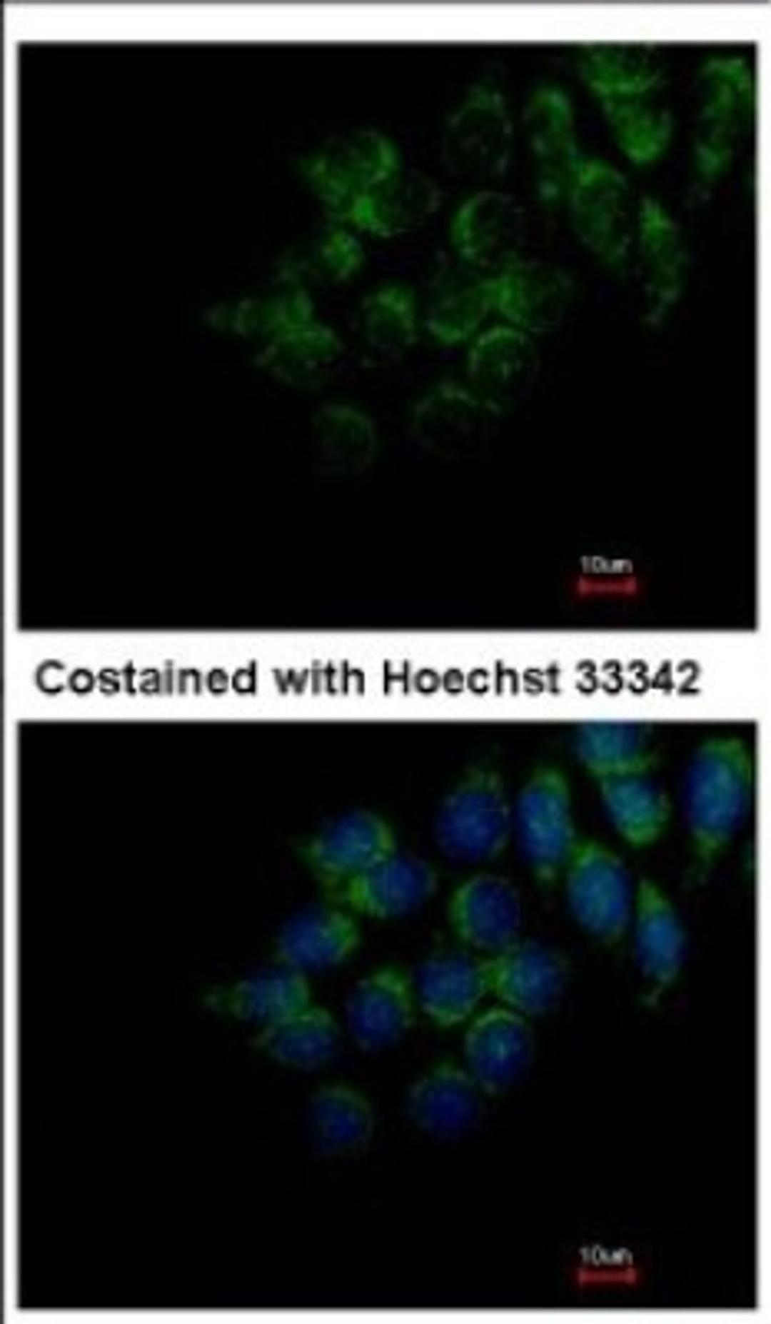 Immunocytochemistry/Immunofluorescence: FAM20C Antibody [NBP2-16415] - Immunofluorescence analysis of methanol-fixed Hep3B, using antibody at 1:200 dilution.