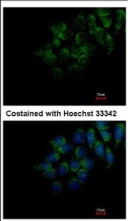 Immunocytochemistry/Immunofluorescence: FAM20C Antibody [NBP2-16415] - Immunofluorescence analysis of methanol-fixed Hep3B, using antibody at 1:200 dilution.