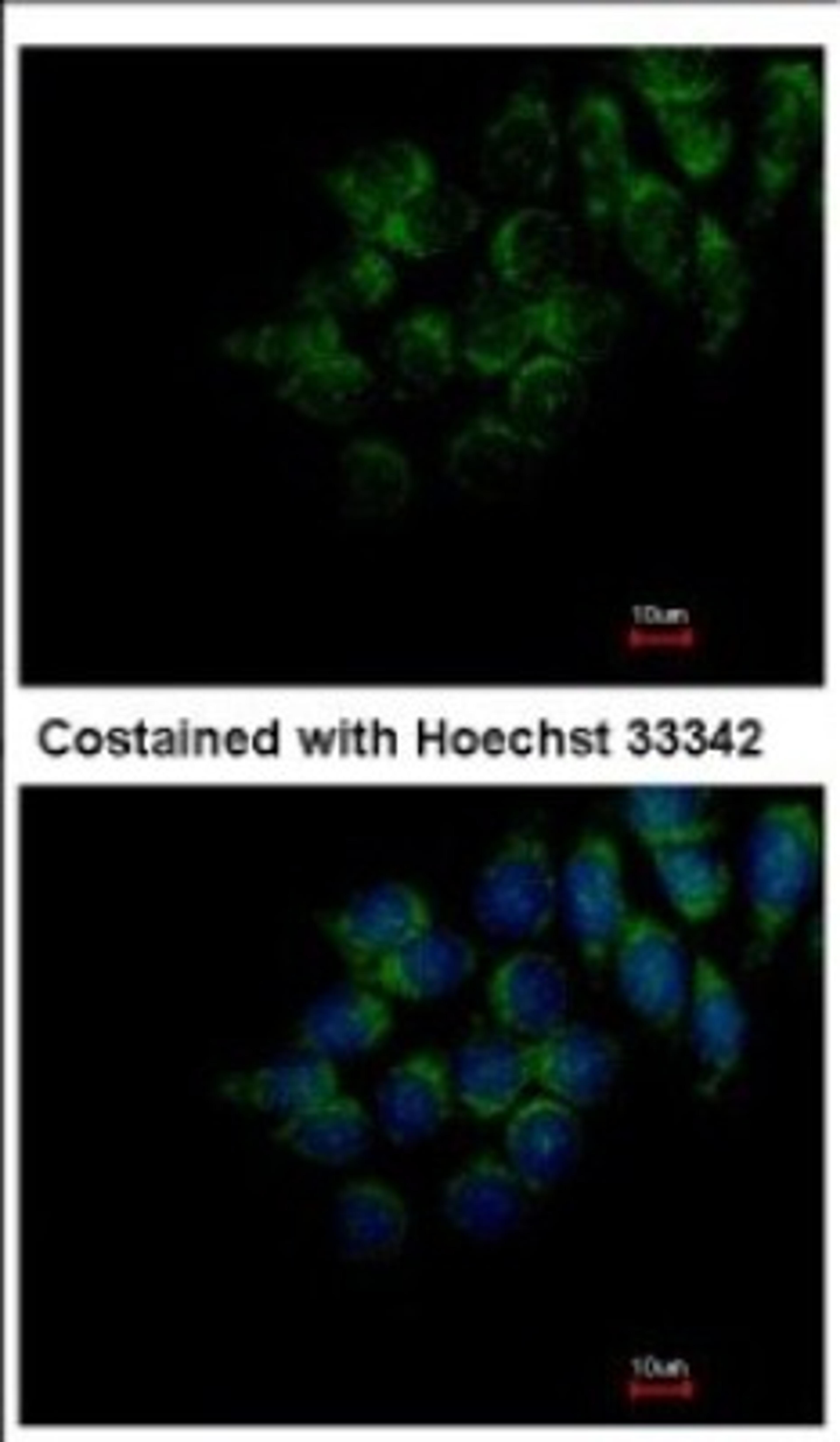 Immunocytochemistry/Immunofluorescence: FAM20C Antibody [NBP2-16415] - Immunofluorescence analysis of methanol-fixed Hep3B, using antibody at 1:200 dilution.