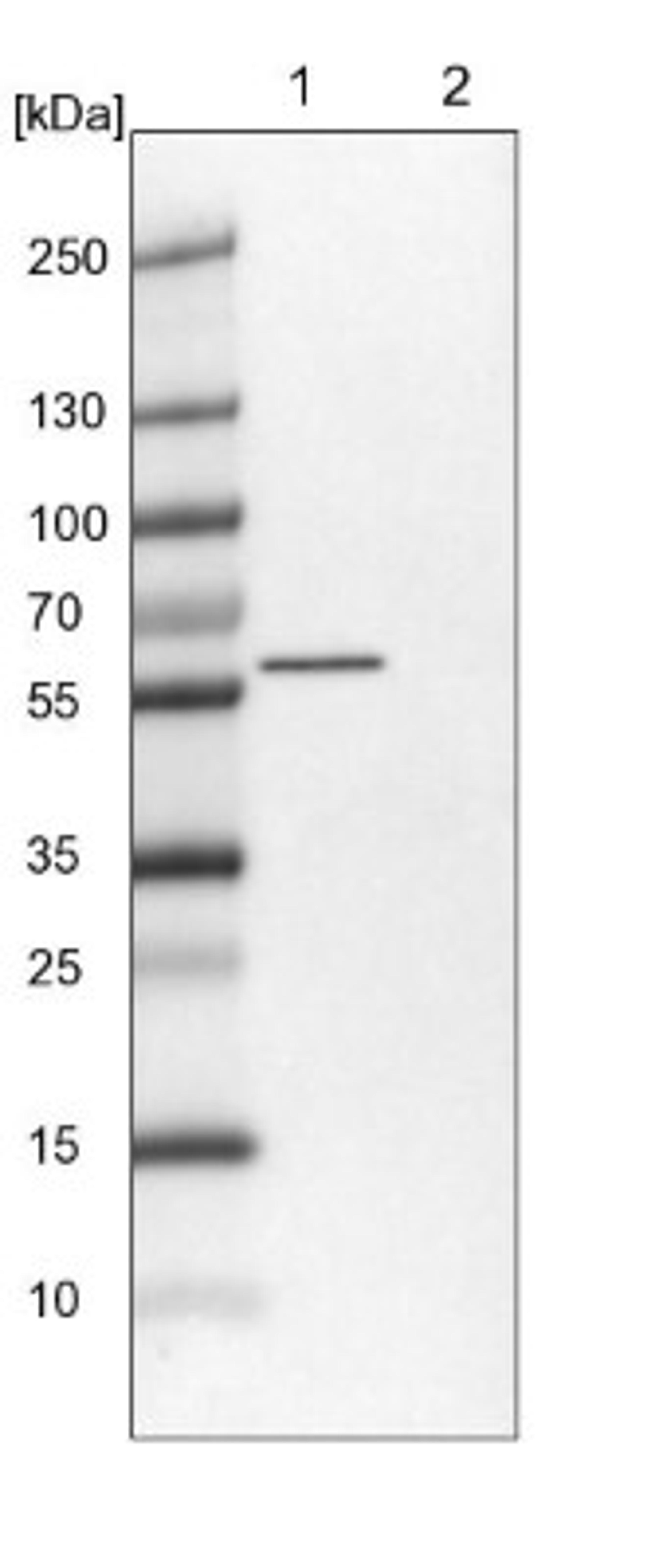 Western Blot: ZDHHC6 Antibody [NBP1-82132] - Lane 1: NIH-3T3 cell lysate (Mouse embryonic fibroblast cells)<br/>Lane 2: NBT-II cell lysate (Rat Wistar bladder tumour cells)