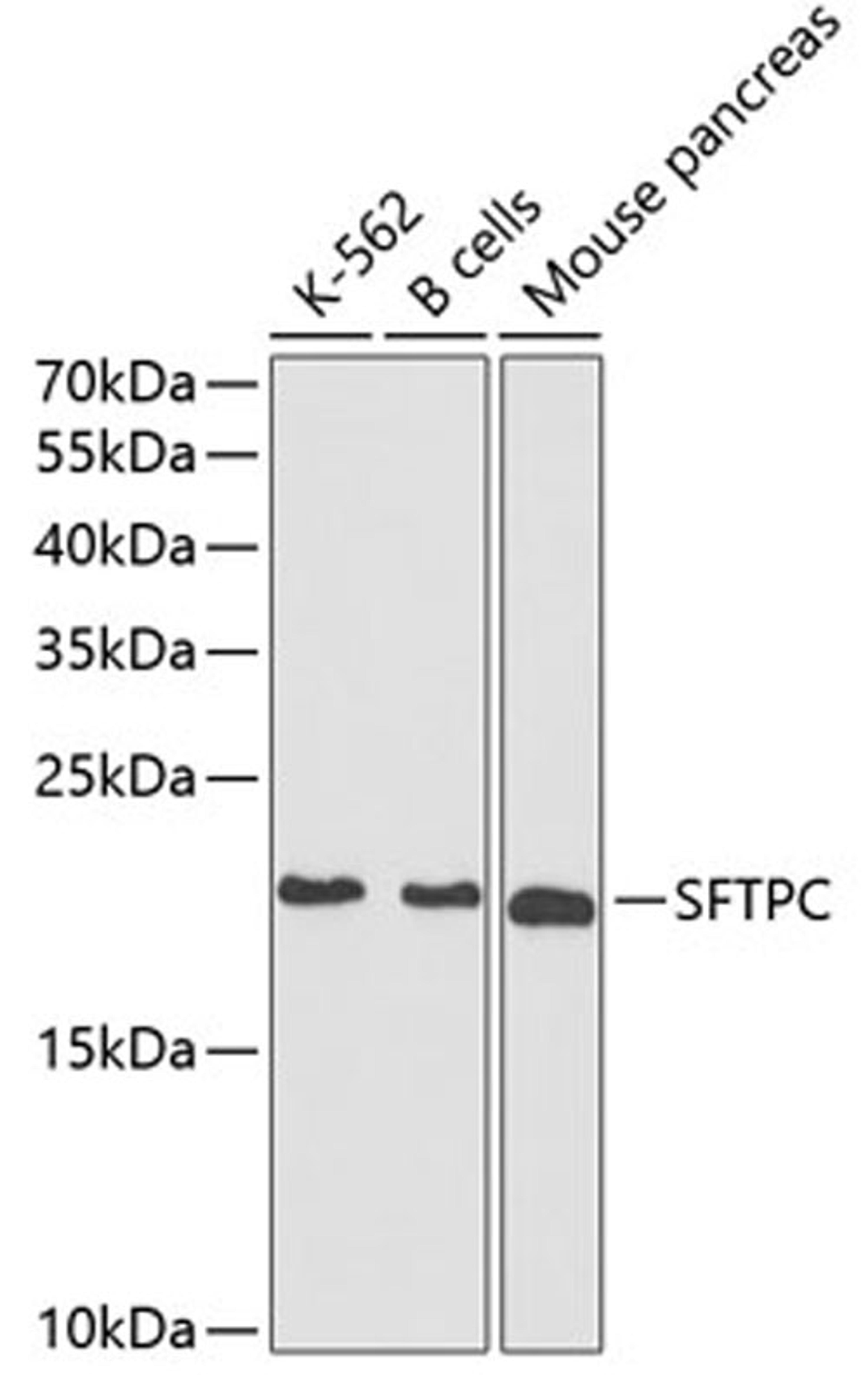 Western blot - SFTPC antibody (A1835)