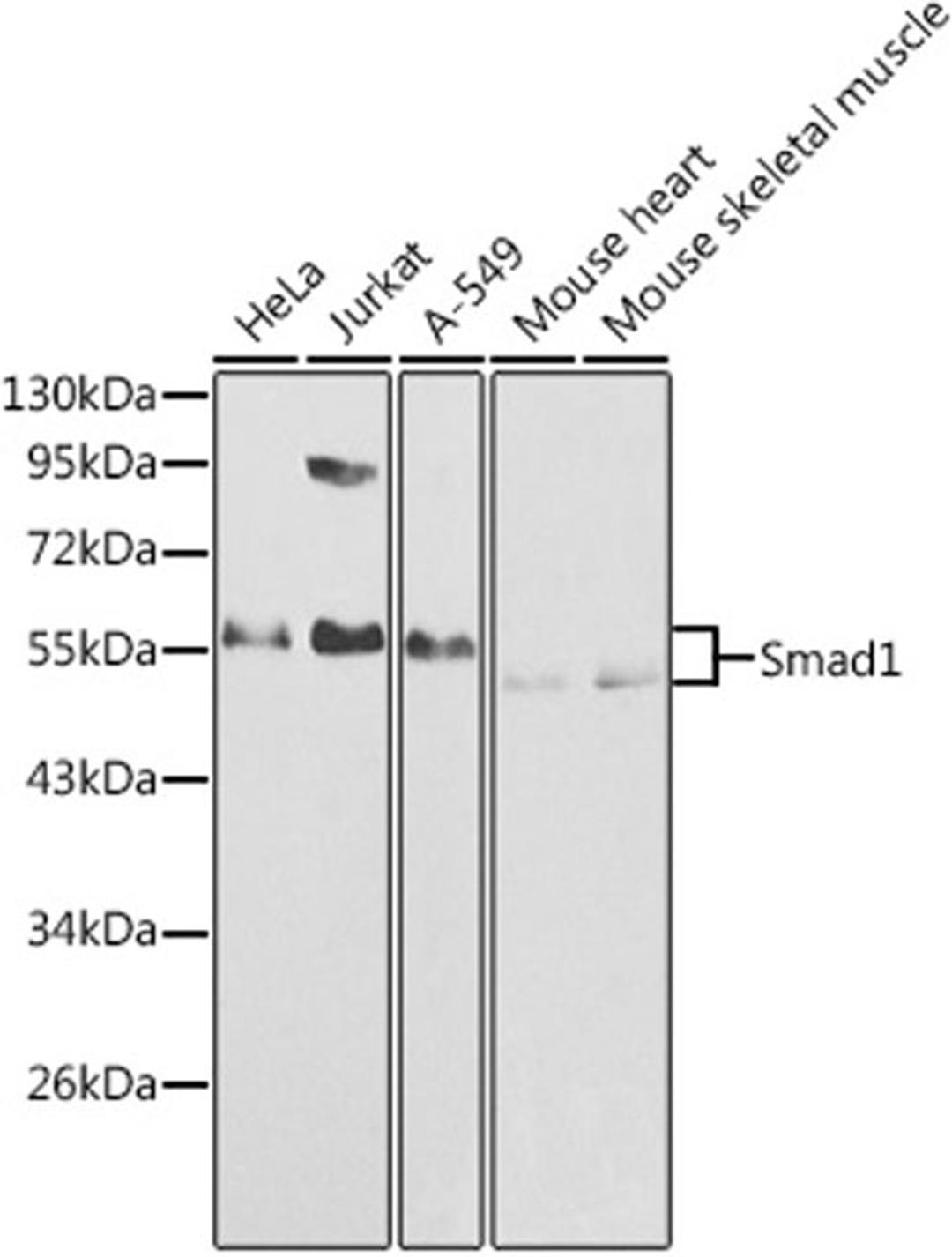 Western blot - Smad1 antibody (A1101)