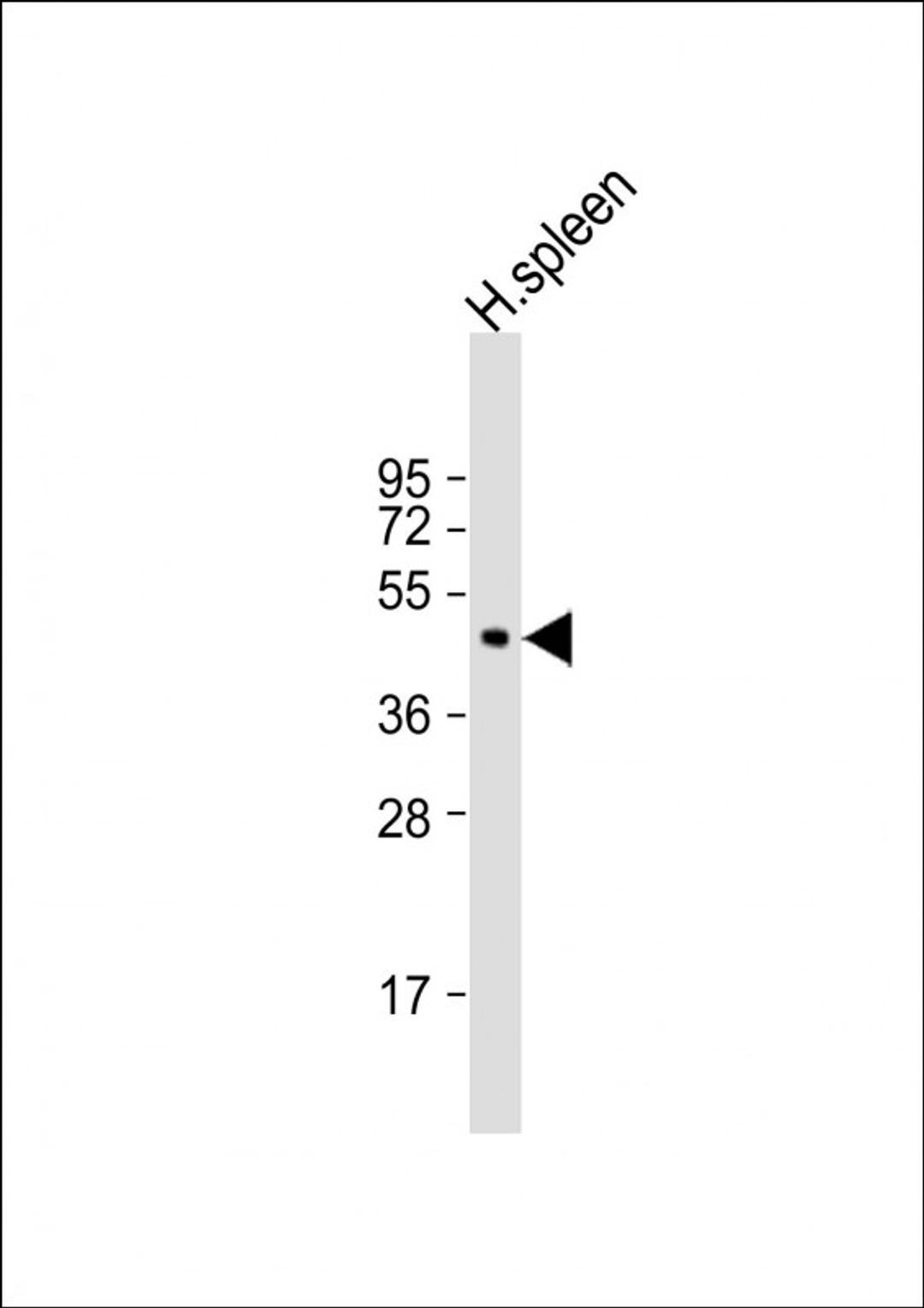 Western Blot at 1:500 dilution + human spleen lysate Lysates/proteins at 20 ug per lane.