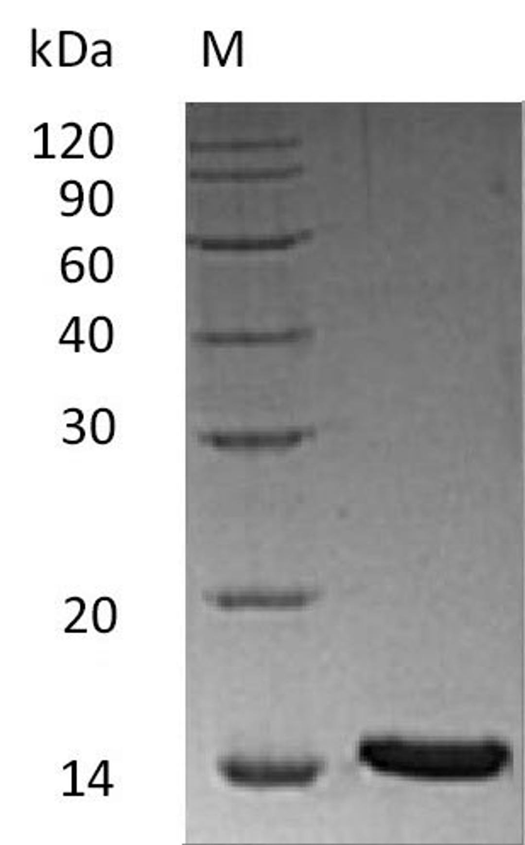(Tris-Glycine gel) Discontinuous SDS-PAGE (reduced) with 5% enrichment gel and 15% separation gel.