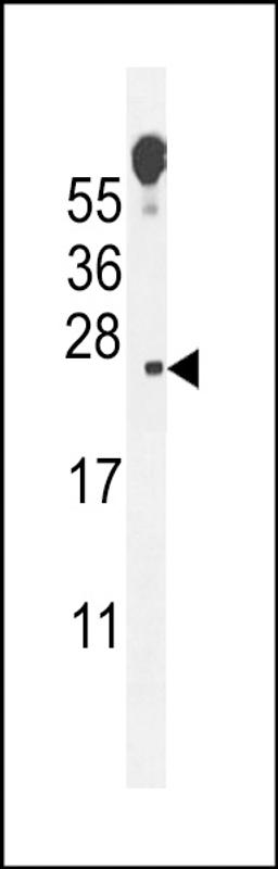 Western blot analysis in mouse lung tissue lysates (35ug/lane).