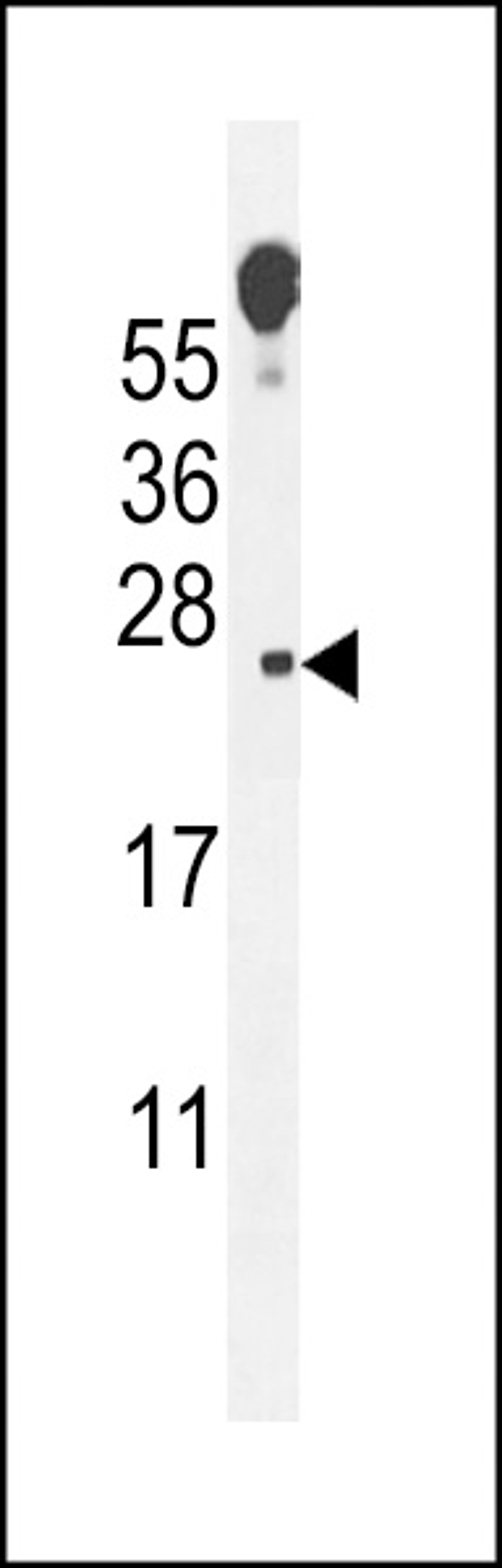 Western blot analysis in mouse lung tissue lysates (35ug/lane).