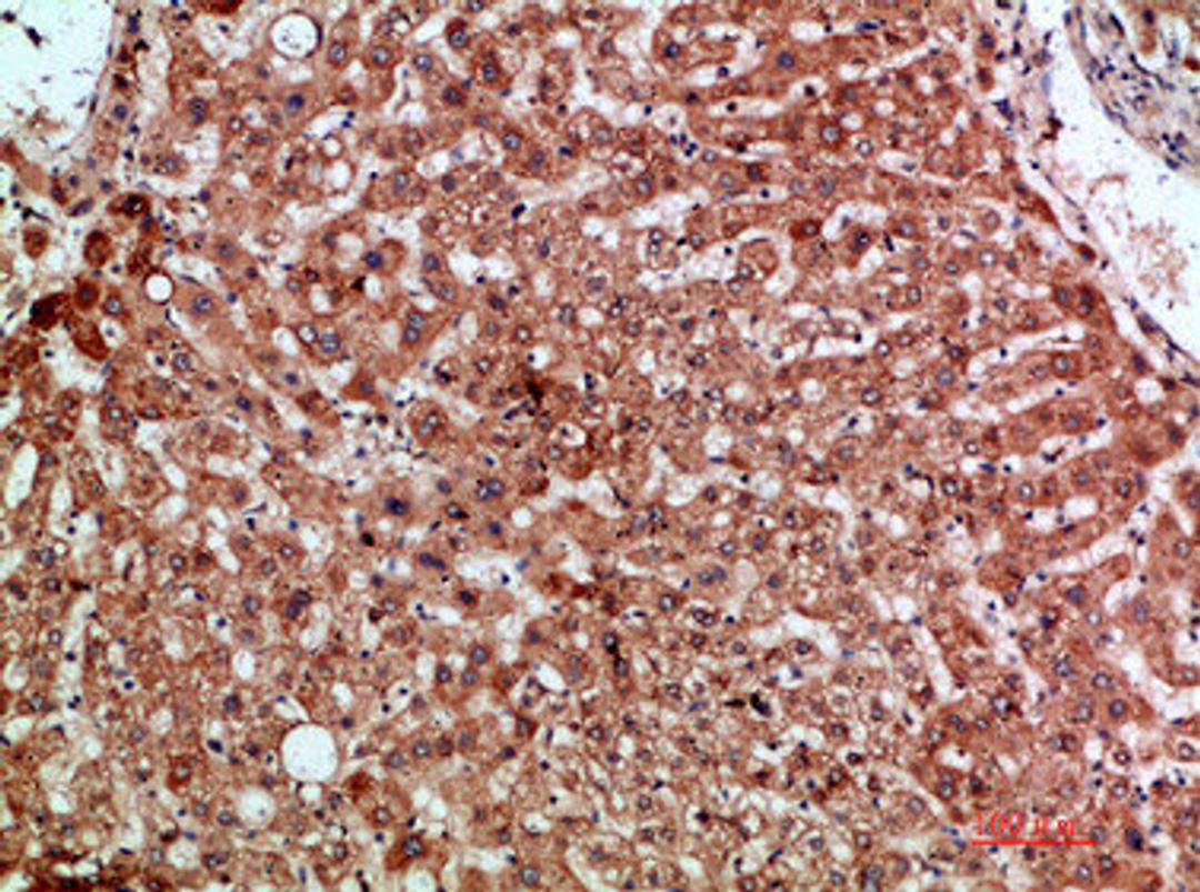 Immunohistochemical analysis of paraffin-embedded human-liver, antibody was diluted at 1:200