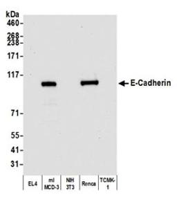 Detection of mouse E-Cadherin by western blot.