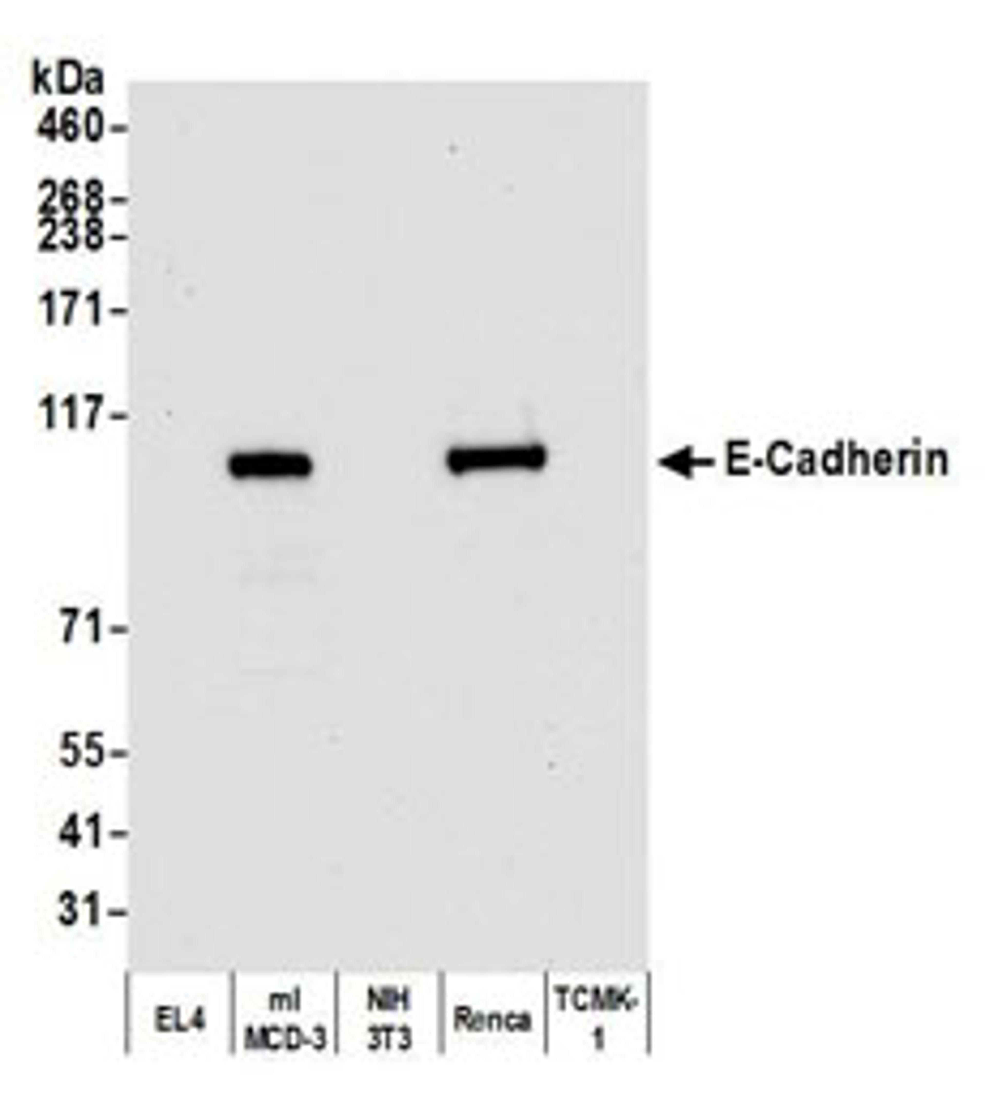 Detection of mouse E-Cadherin by western blot.