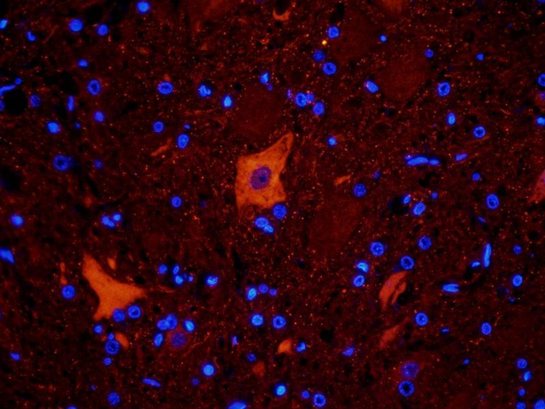 Immunofluorescence analysis of rat spinal cord tissue using  LC3 antibody (dilution of primary antibody - 2.5 ug/ml)