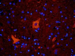 Immunofluorescence analysis of rat spinal cord tissue using  LC3 antibody (dilution of primary antibody - 2.5 ug/ml)