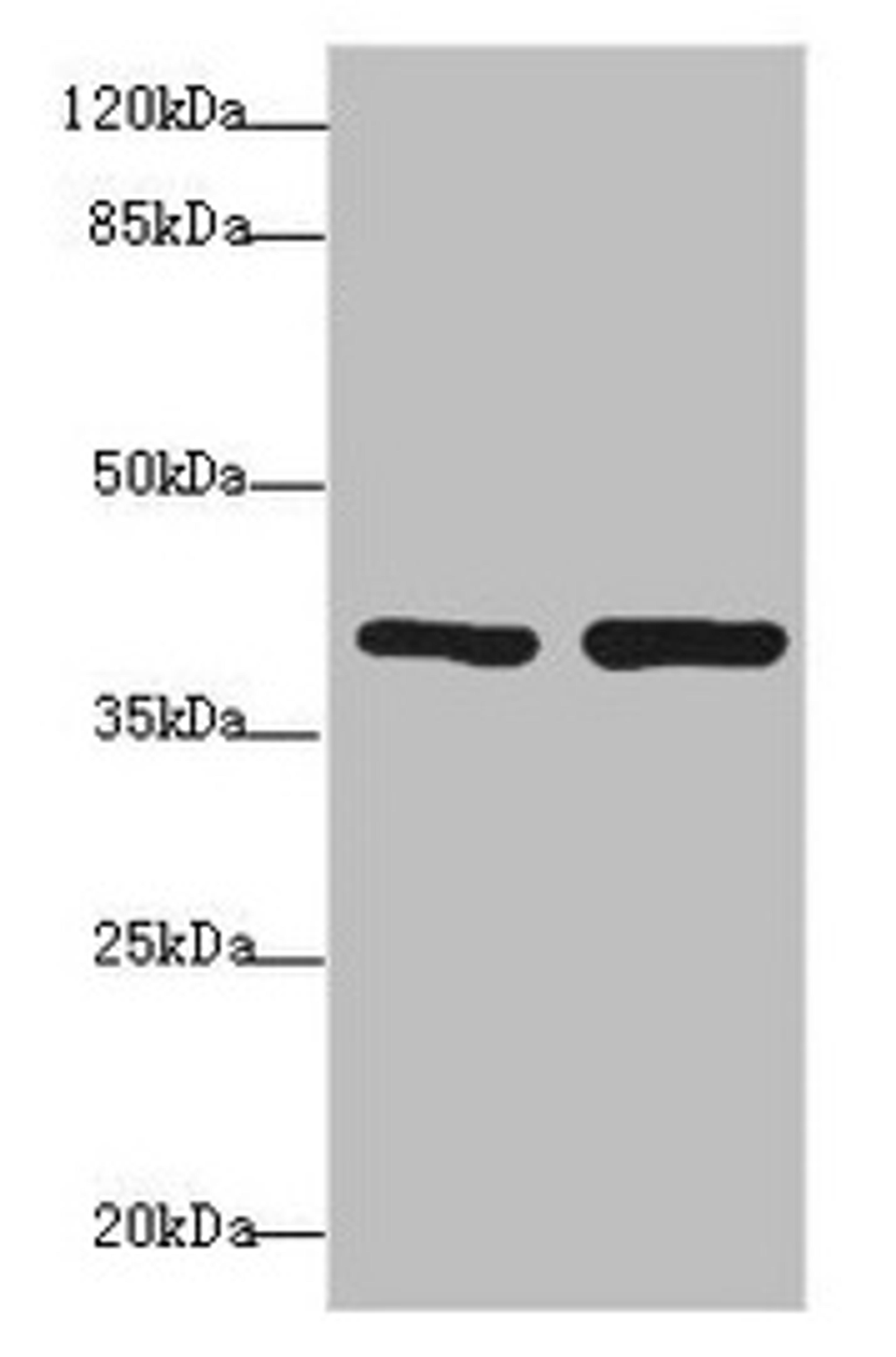 Western blot. All lanes: PDCD2L antibody at 1.69µg/ml. Lane 1: Hela whole cell lysate. Lane 2: MCF-7 whole cell lysate. Secondary. Goat polyclonal to rabbit IgG at 1/10000 dilution. Predicted band size: 39 kDa. Observed band size: 39 kDa