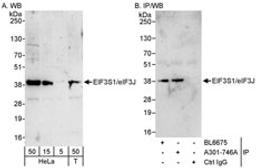 Detection of human eIF3J/EIF3S1 by western blot and immunoprecipitation.