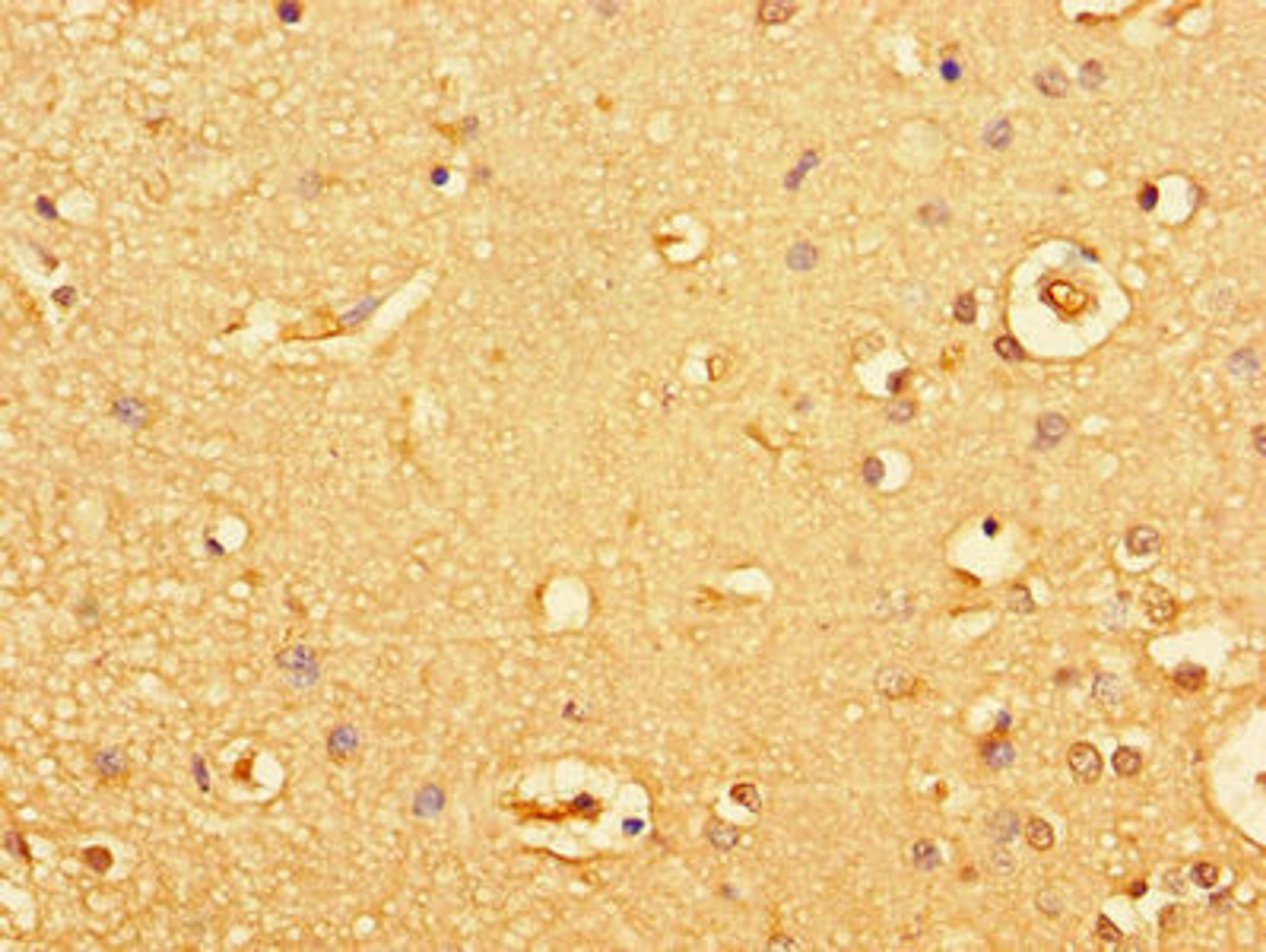 Immunohistochemistry of paraffin-embedded human brain tissue using CSB-PA010053LA01HU at dilution of 1:100