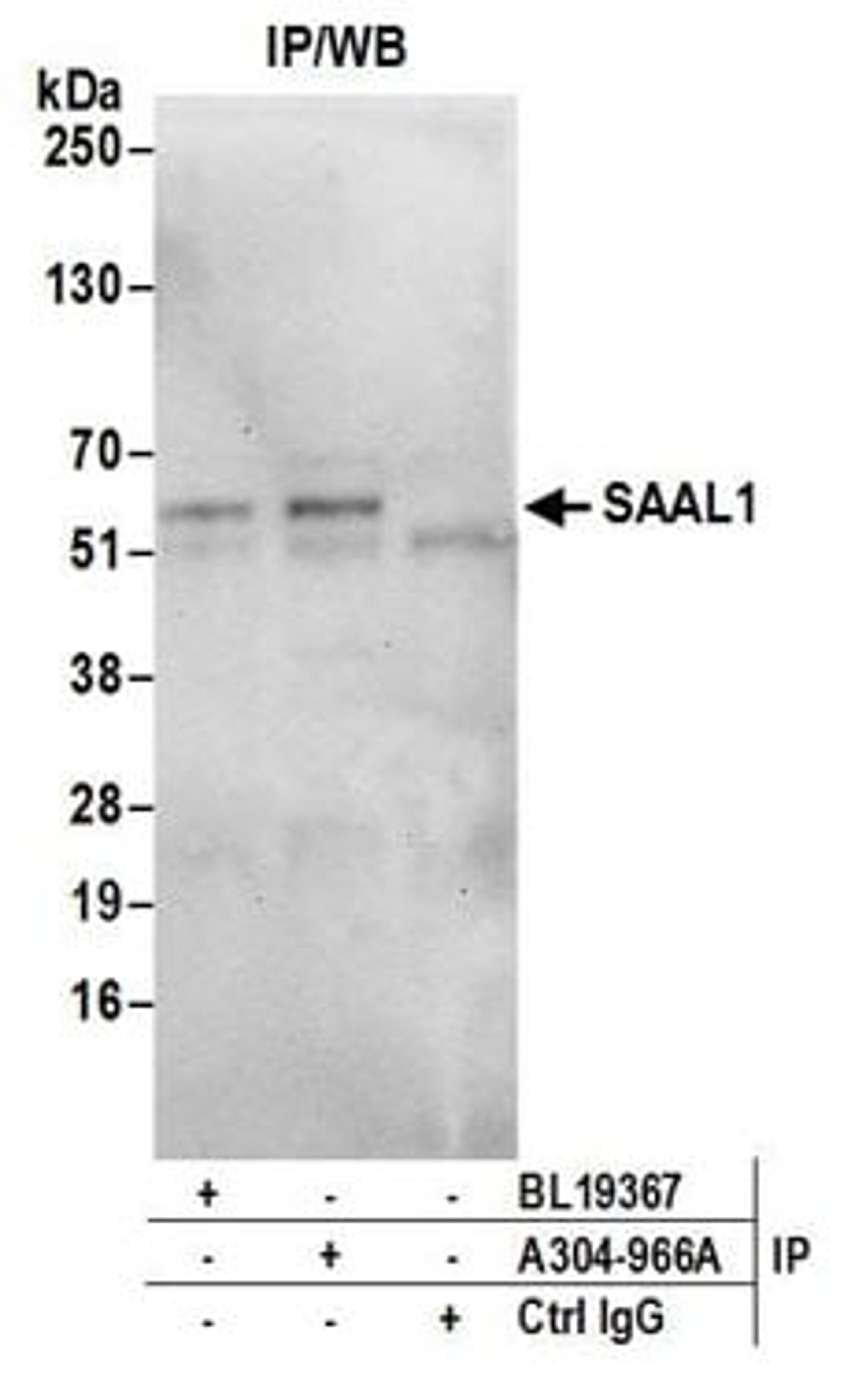 Detection of human SAAL1 by western blot of immunoprecipitates.