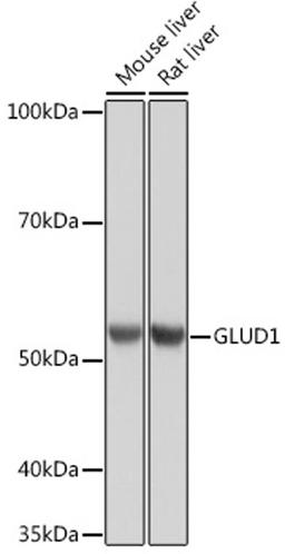 Western blot - GLUD1 Rabbit mAb (A5176)