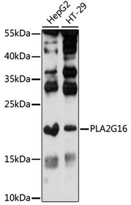 Western blot - PLA2G16 antibody (A16018)