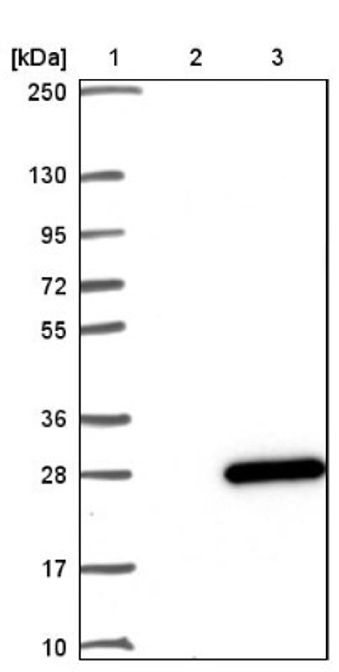 Western Blot: B9D2 Antibody [NBP1-91693] - Lane 1: Marker [kDa] 250, 130, 95, 72, 55, 36, 28, 17, 10<br/>Lane 2: Negative control (vector only transfected HEK293T lysate)<br/>Lane 3: Over-expression lysate (Co-expressed with a C-terminal myc-DDK tag (~3.1 kDa) in mammalian HEK293T cells, LY410782)