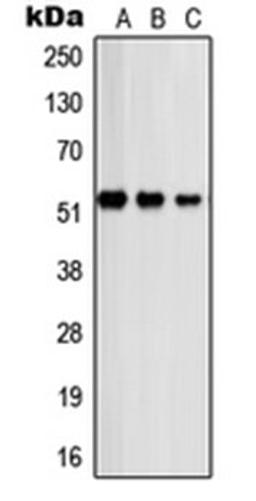 Western blot analysis of A431 (Lane 1), COLO320 (Lane 2), HeLa (Lane 3) whole cell lysates using PSMD12 antibody