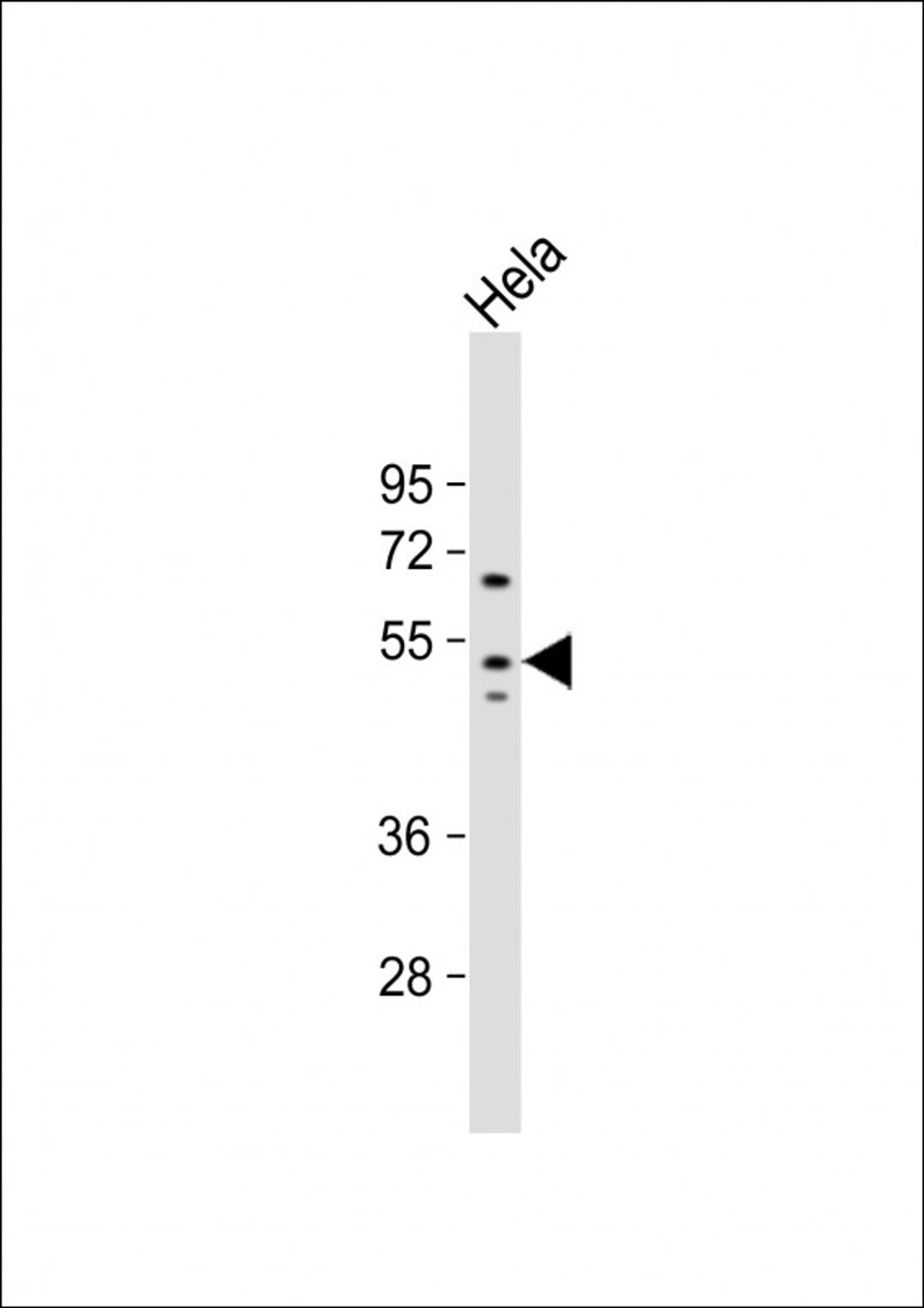 Western Blot at 1:1000 dilution + Hela whole cell lysate Lysates/proteins at 20 ug per lane.