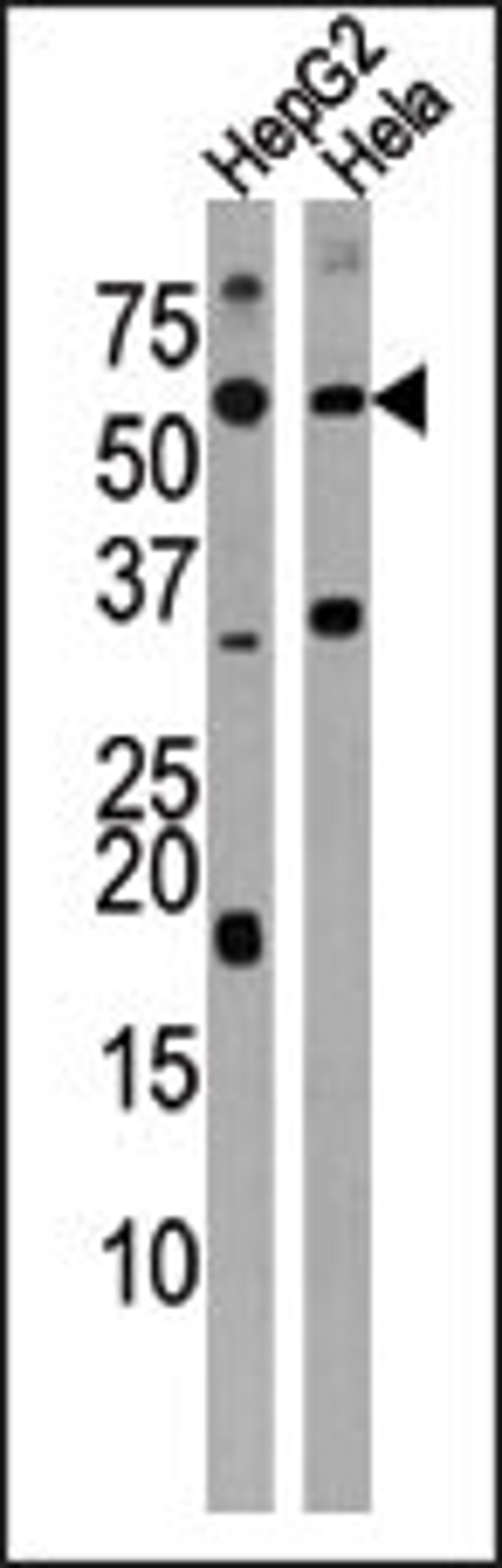 Western blot analysis of anti-ACVR1C Antibody (N-term A48) in HepG2 and Hela cell line lysate (35ug/lane)